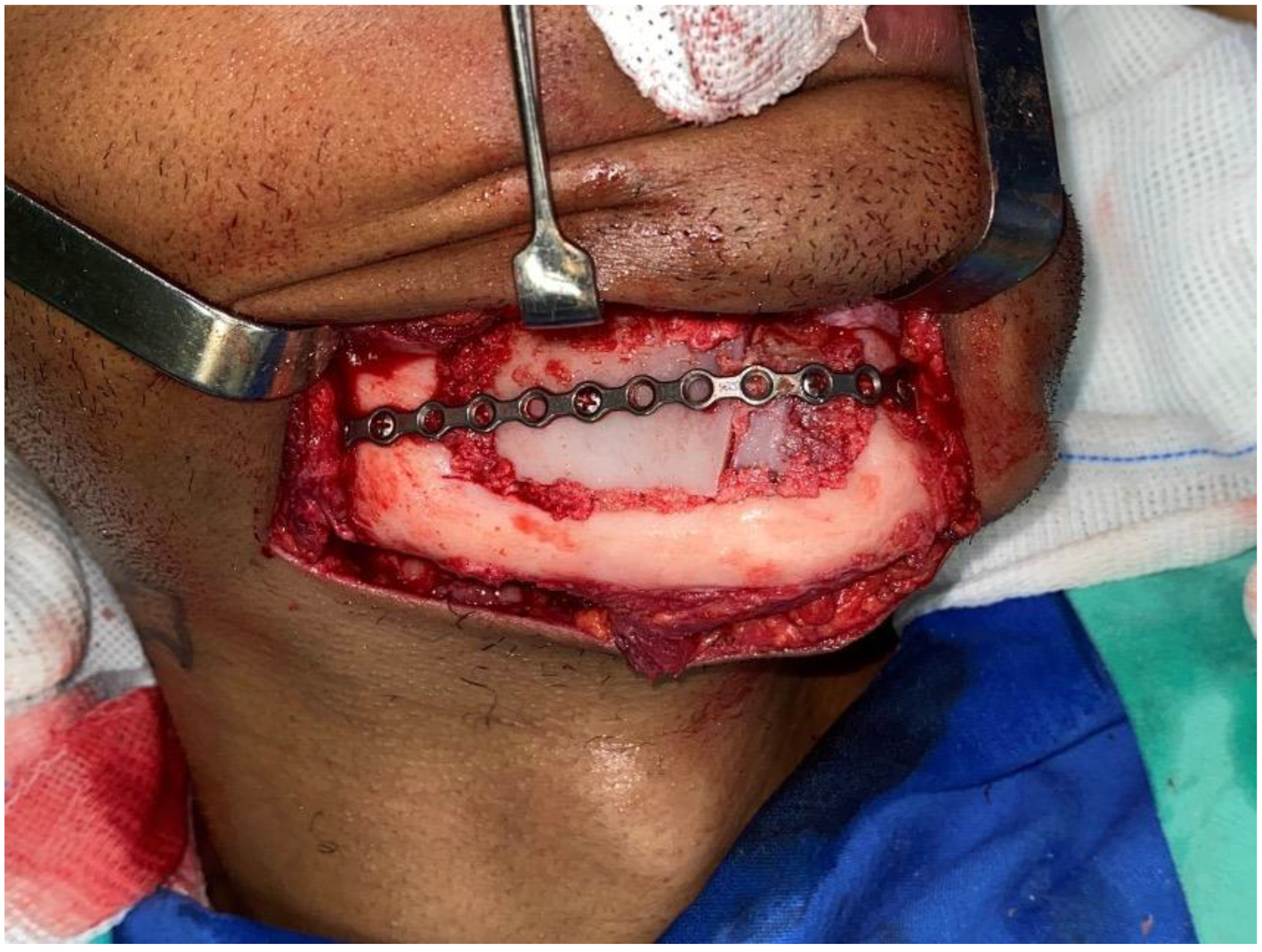 Dentistry 12 00192 g016 Dentistry 12 00192 g016
