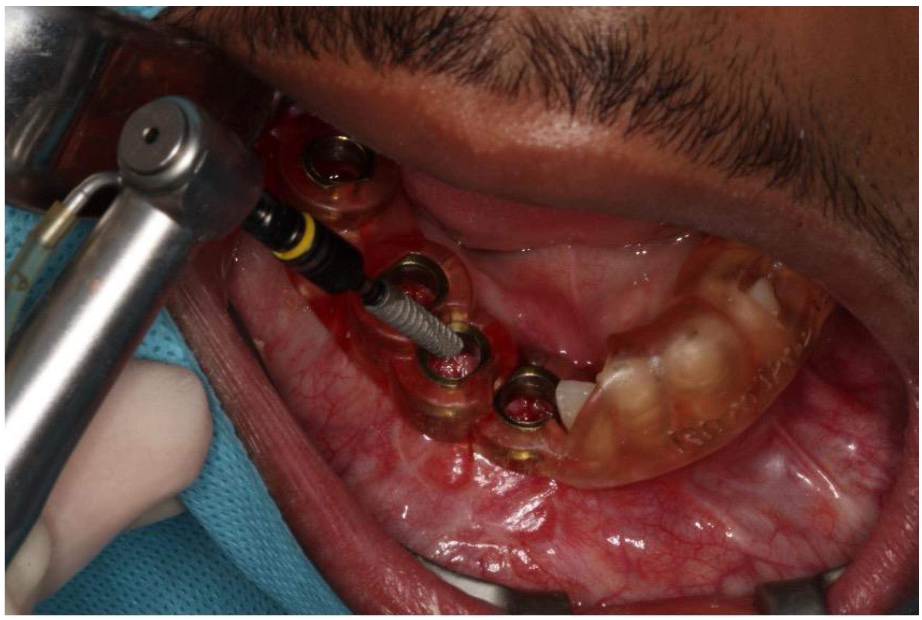 Dentistry 12 00192 g018 Dentistry 12 00192 g018