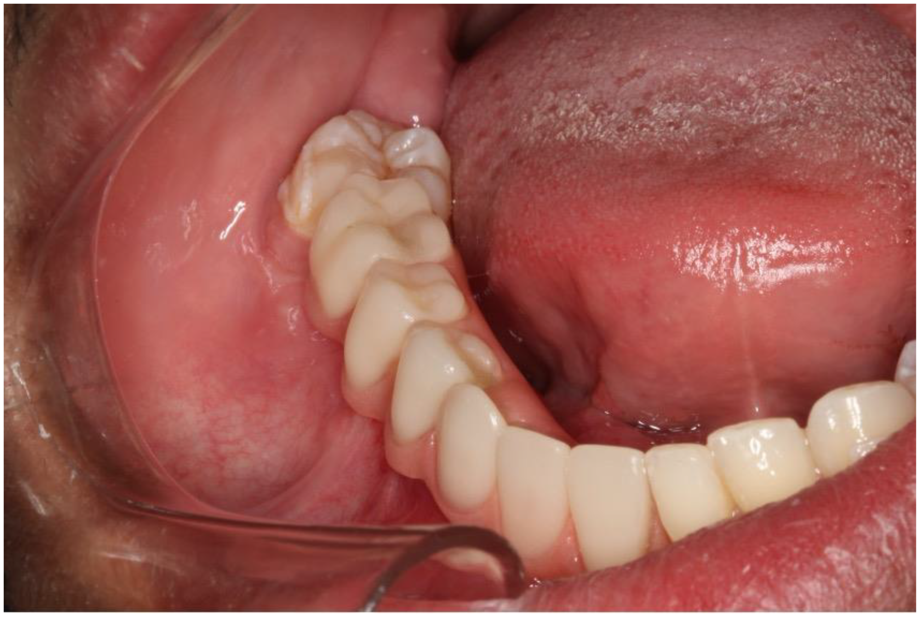 Dentistry 12 00192 g020 Dentistry 12 00192 g020