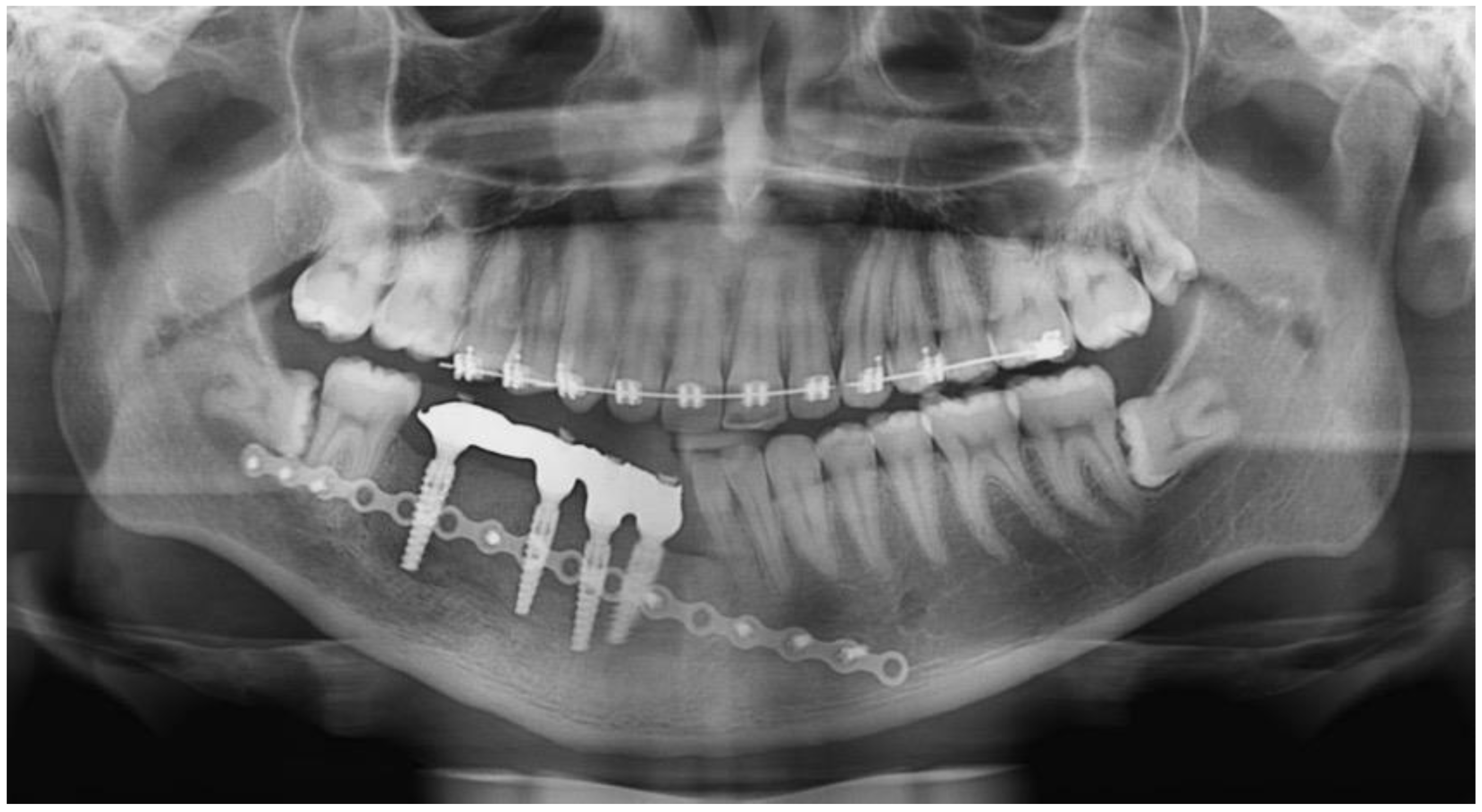 Dentistry 12 00192 g021 Dentistry 12 00192 g021