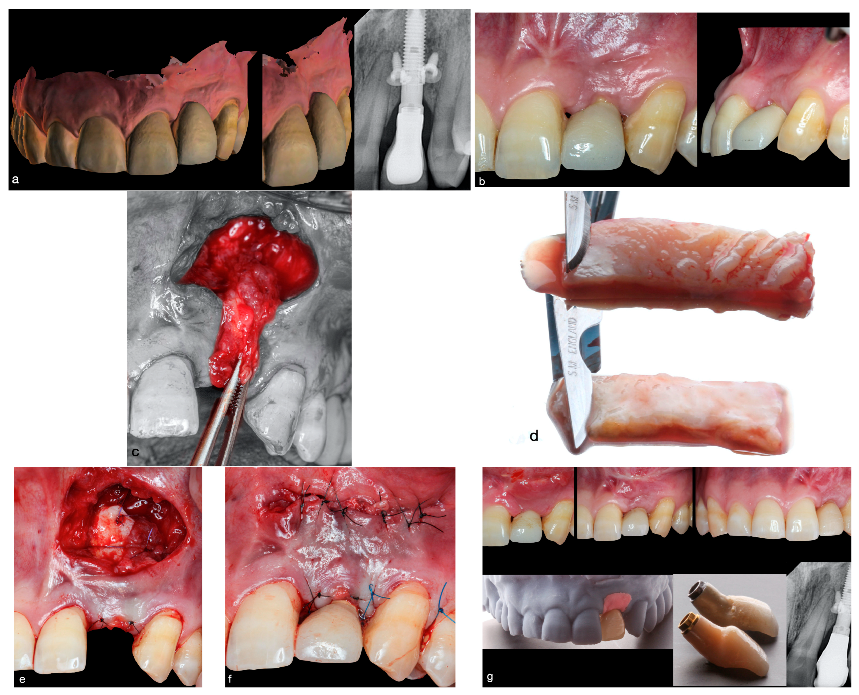 Dentistry 12 00194 g001 Dentistry 12 00194 g001