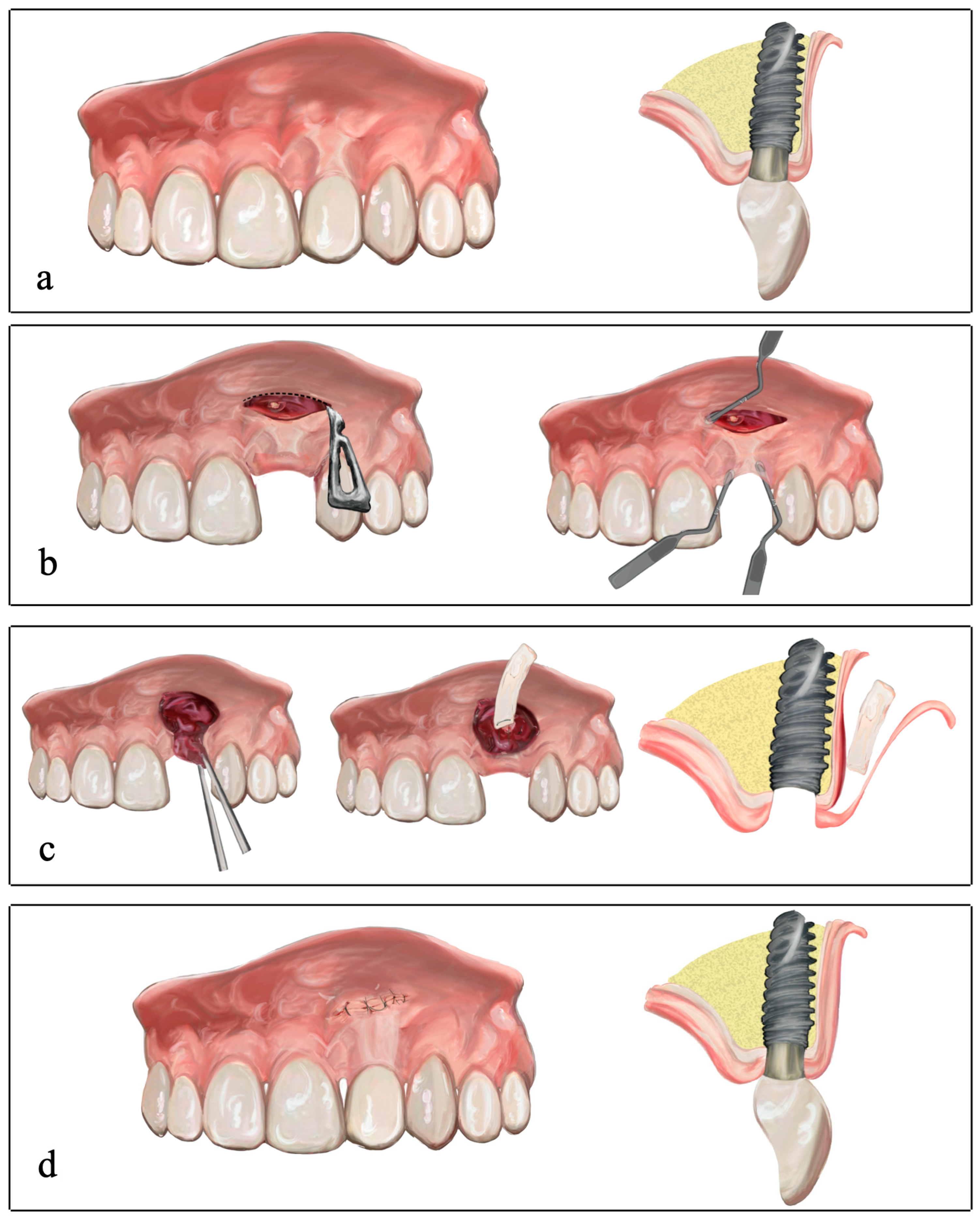 Dentistry 12 00194 g002 Dentistry 12 00194 g002