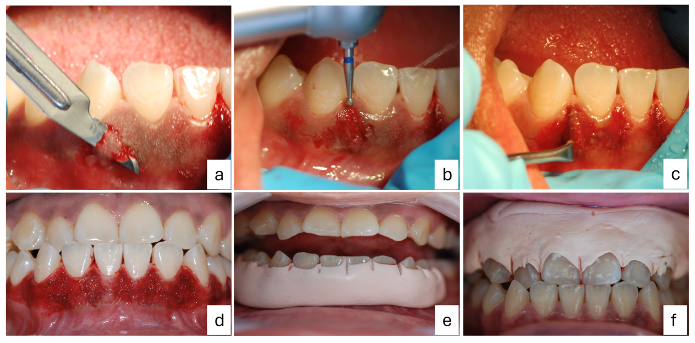 Dentistry 12 00203 g003
