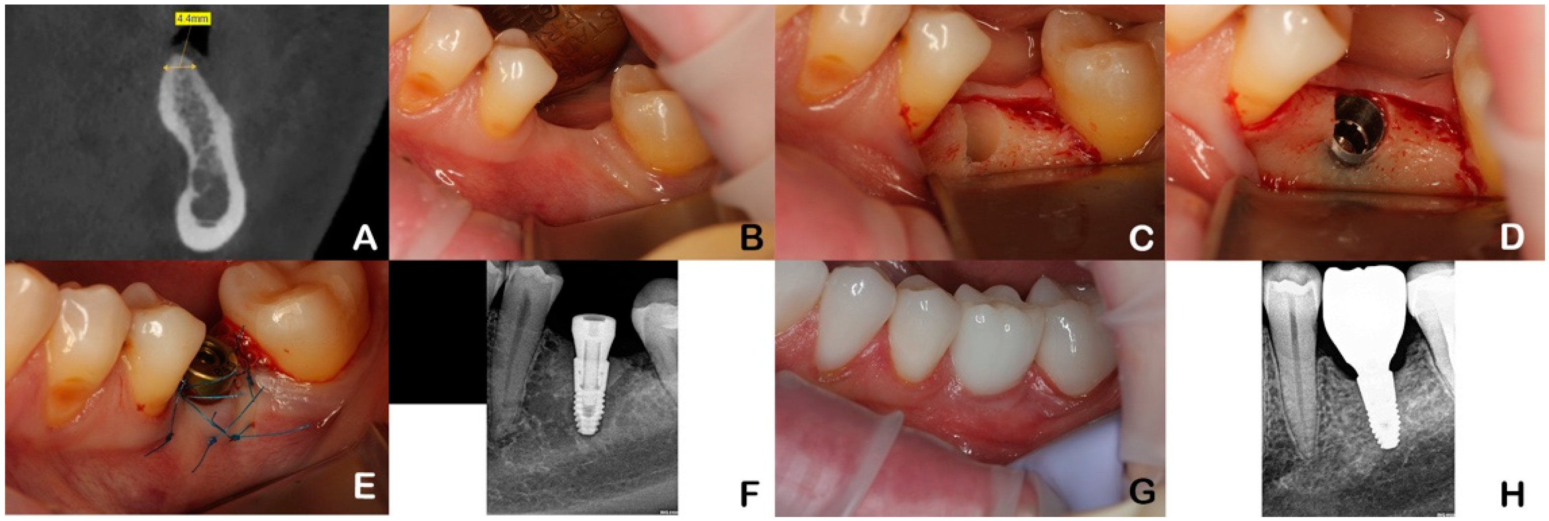 Dentistry 12 00205 g001
