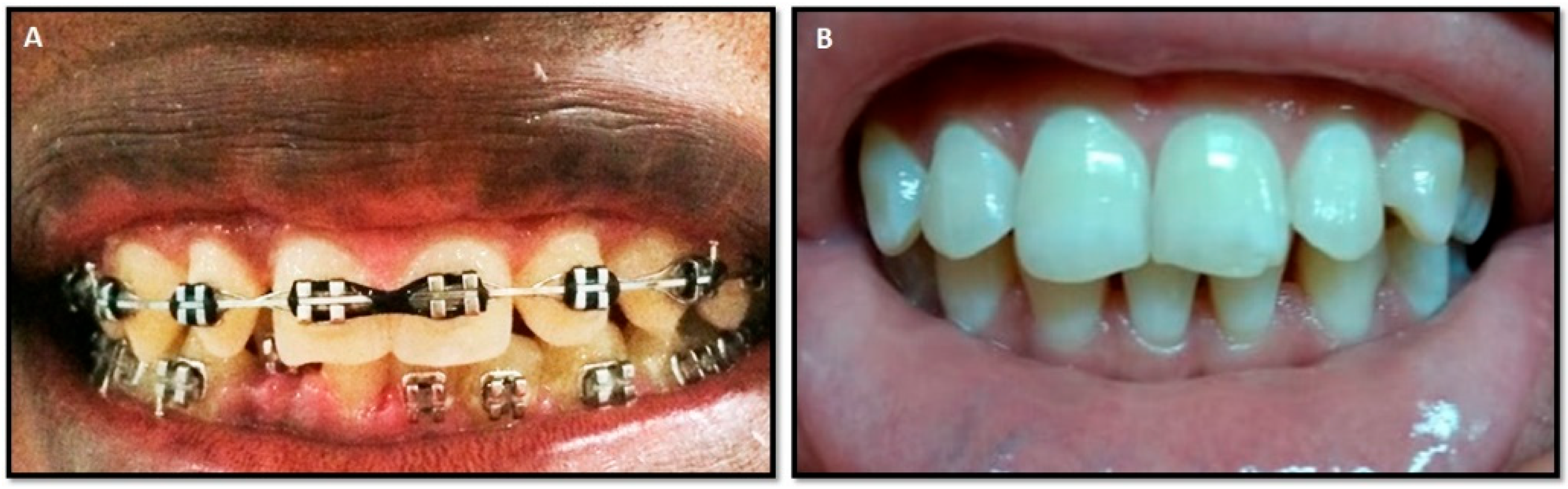 Dentistry 12 00208 g001