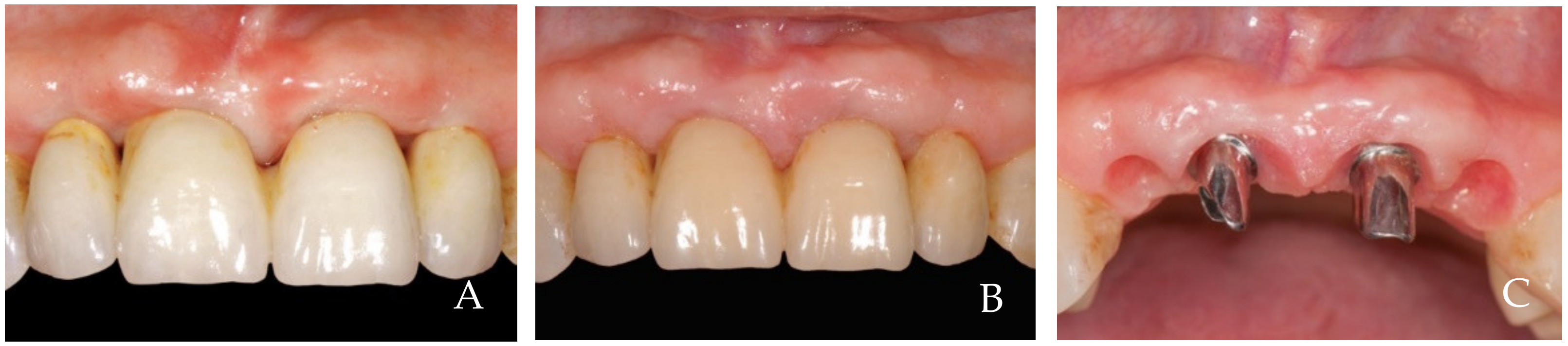 Dentistry 12 00216 g001