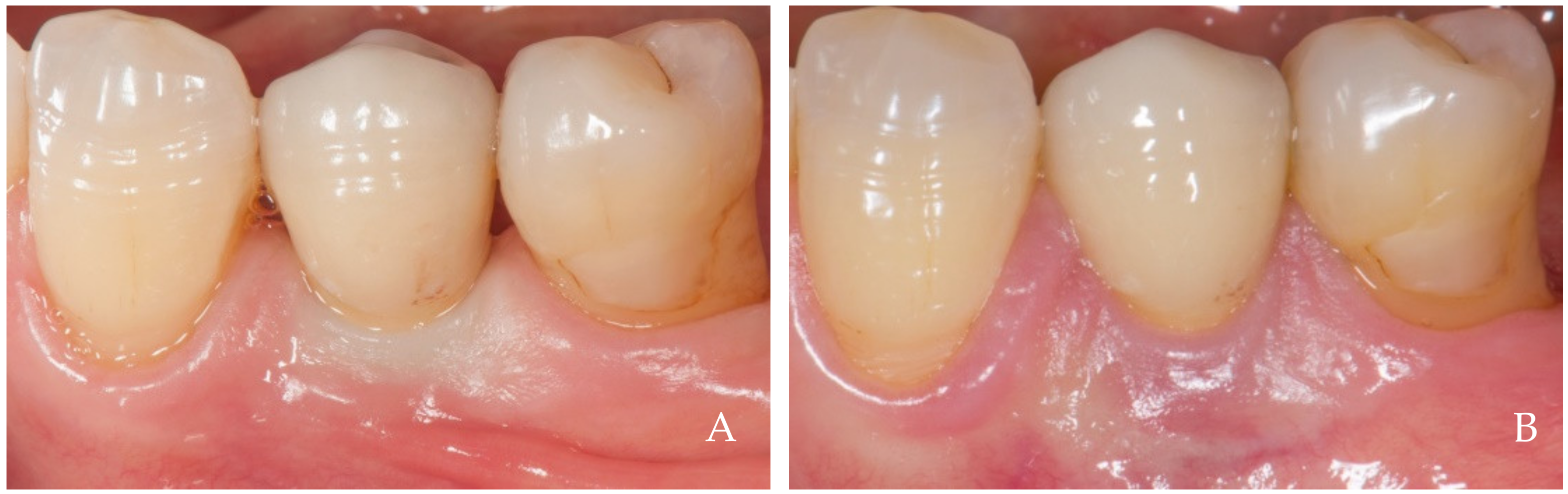 Dentistry 12 00216 g002