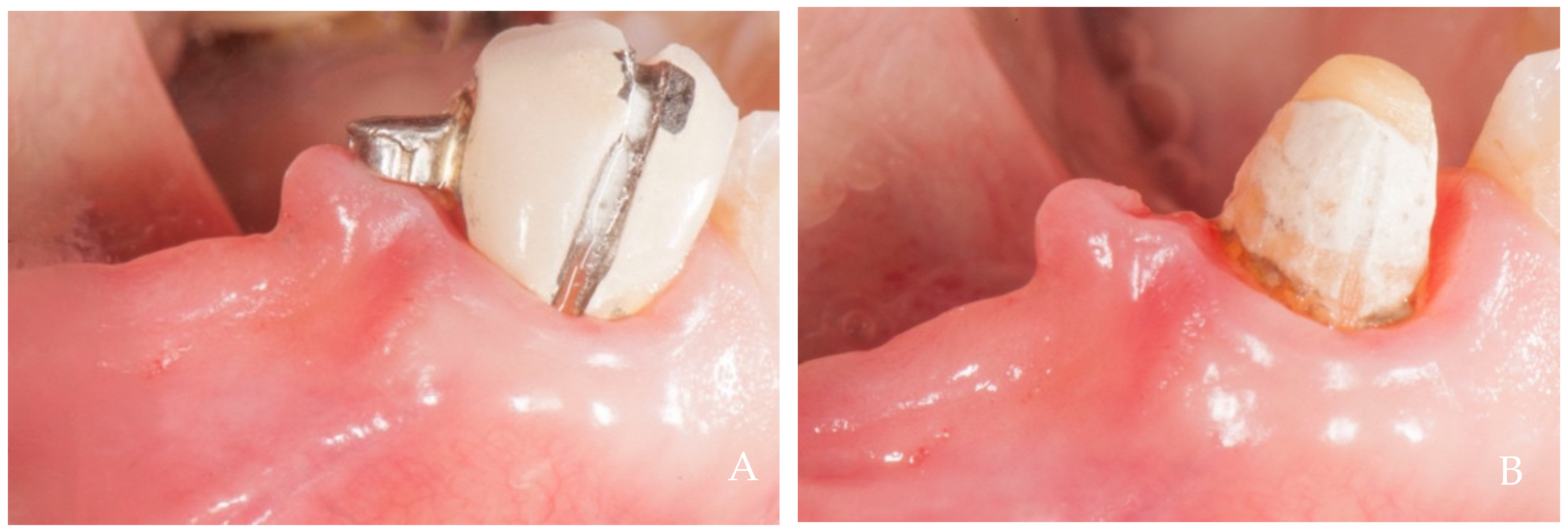 Dentistry 12 00216 g010