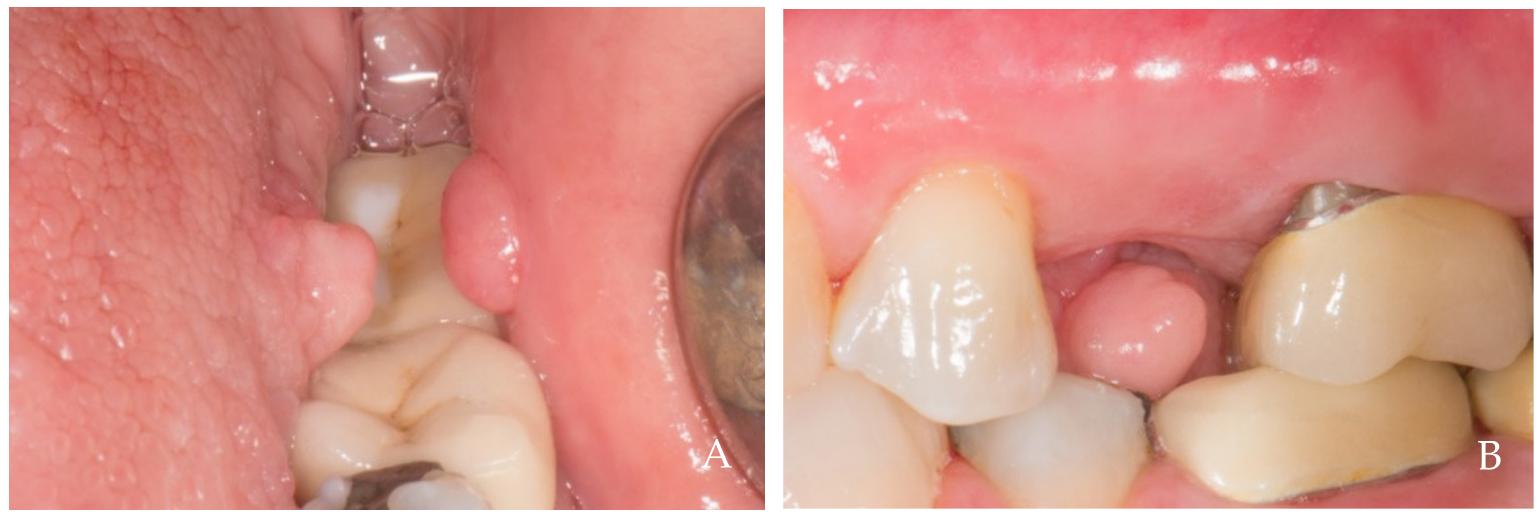 Dentistry 12 00216 g011