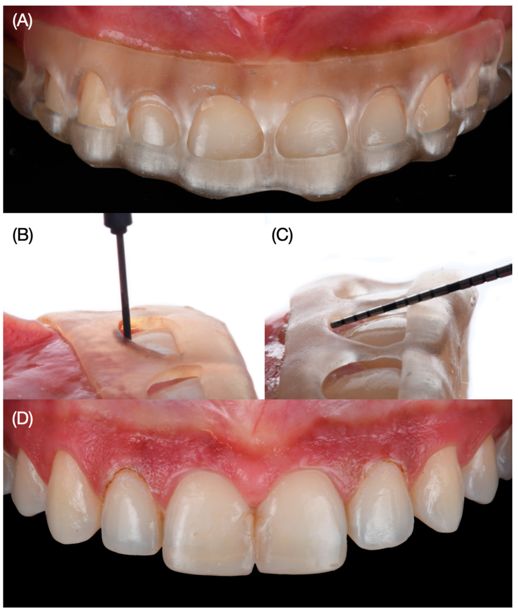 Dentistry 12 00245 g004