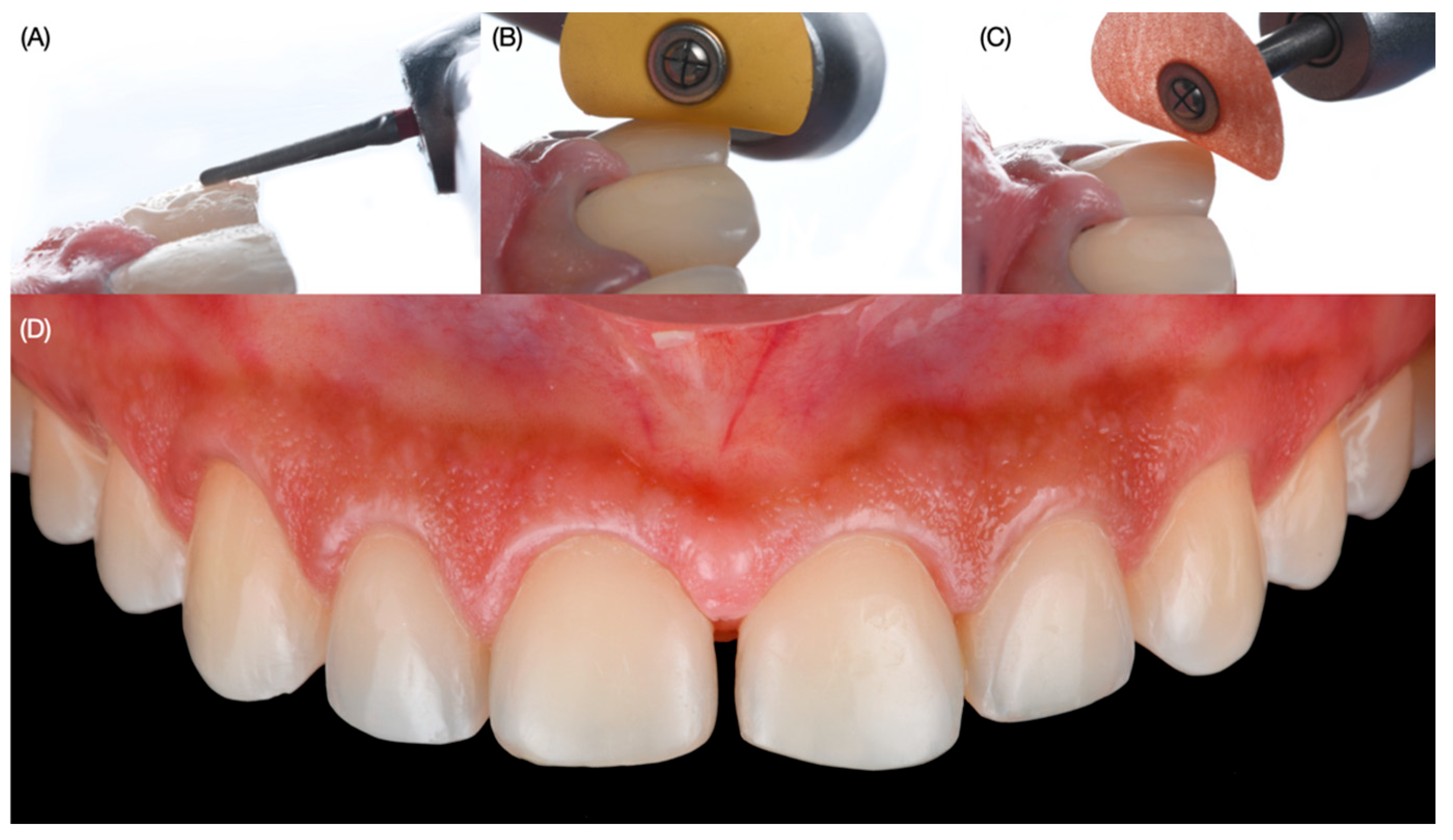 Dentistry 12 00245 g006