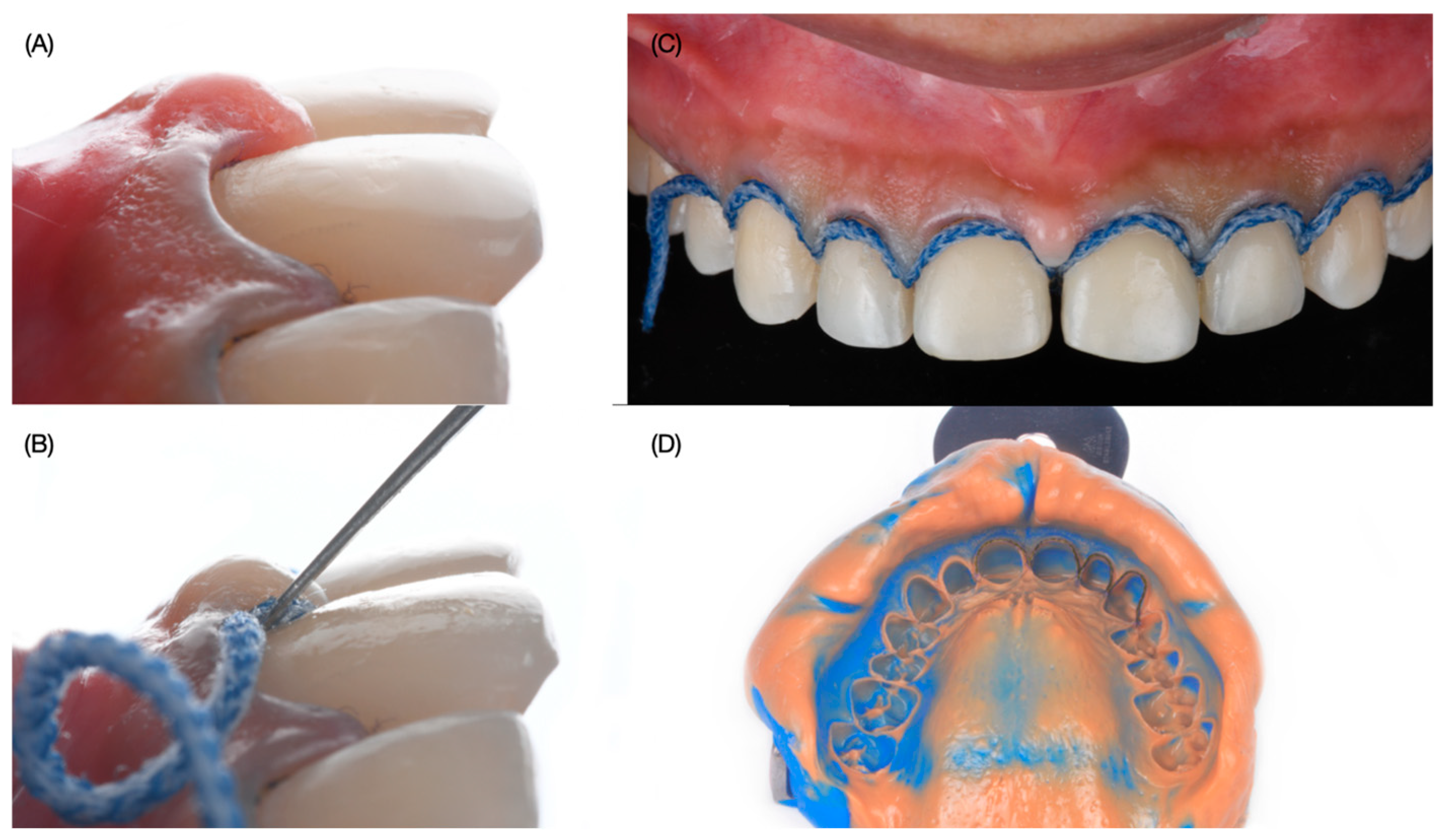 Dentistry 12 00245 g007