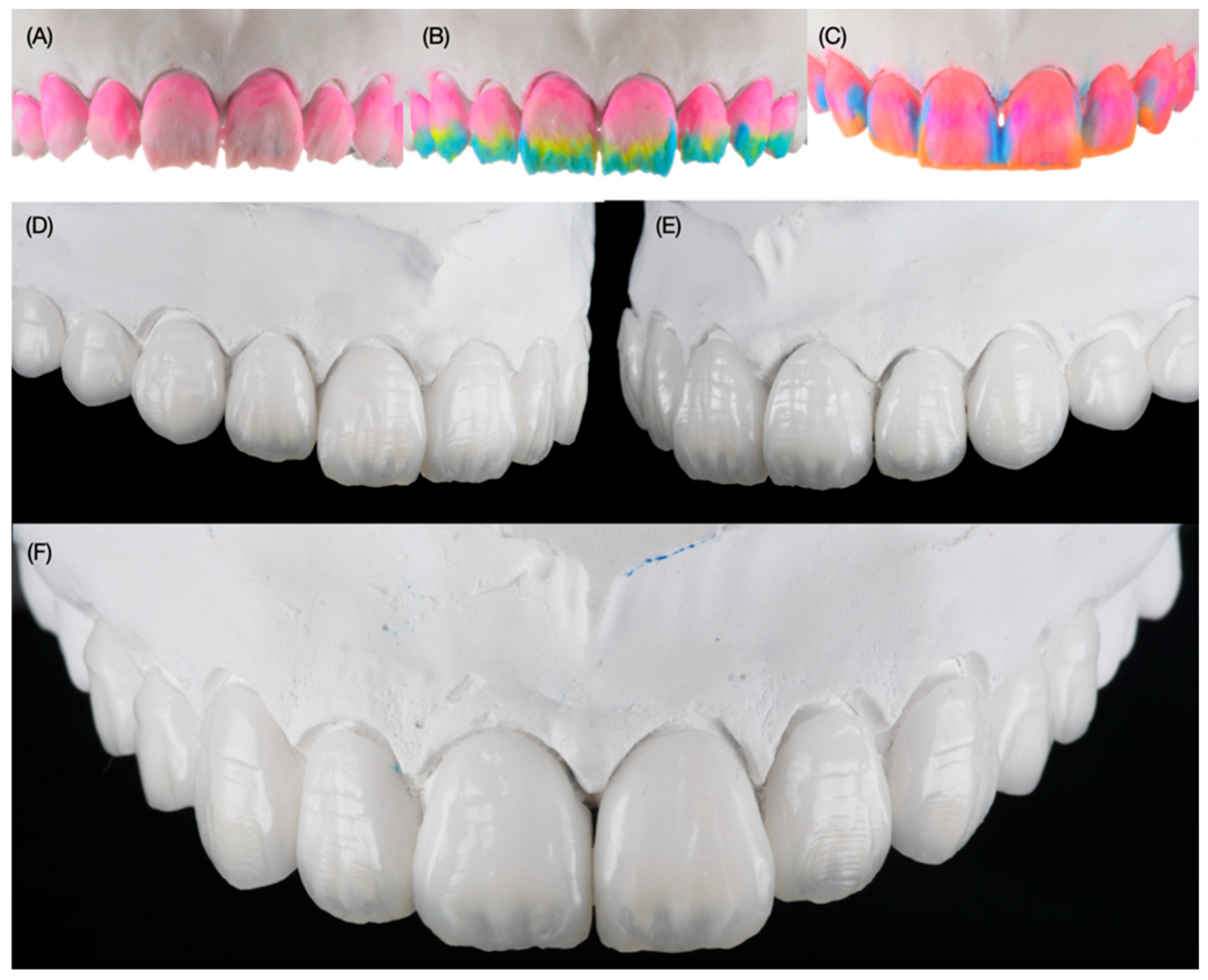 Dentistry 12 00245 g008