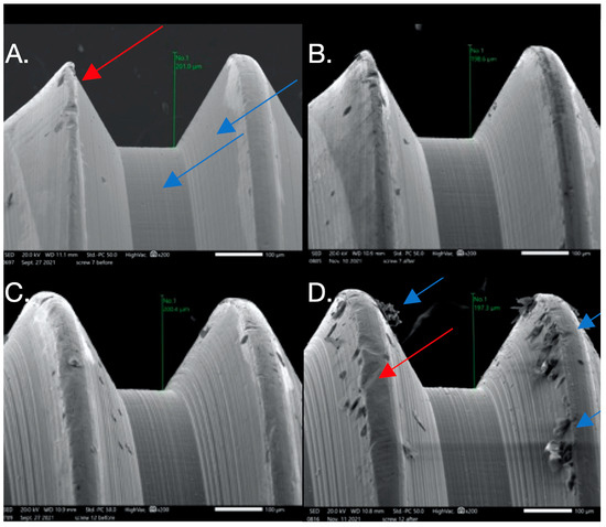 Dentistry 12 00265 g004
