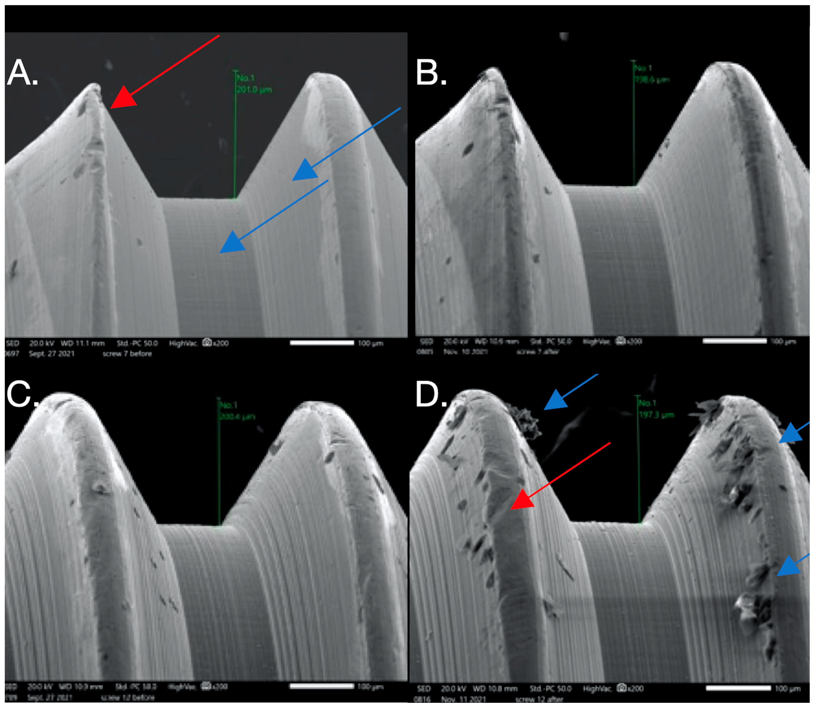 Dentistry 12 00265 g004