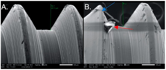 Dentistry 12 00265 g005
