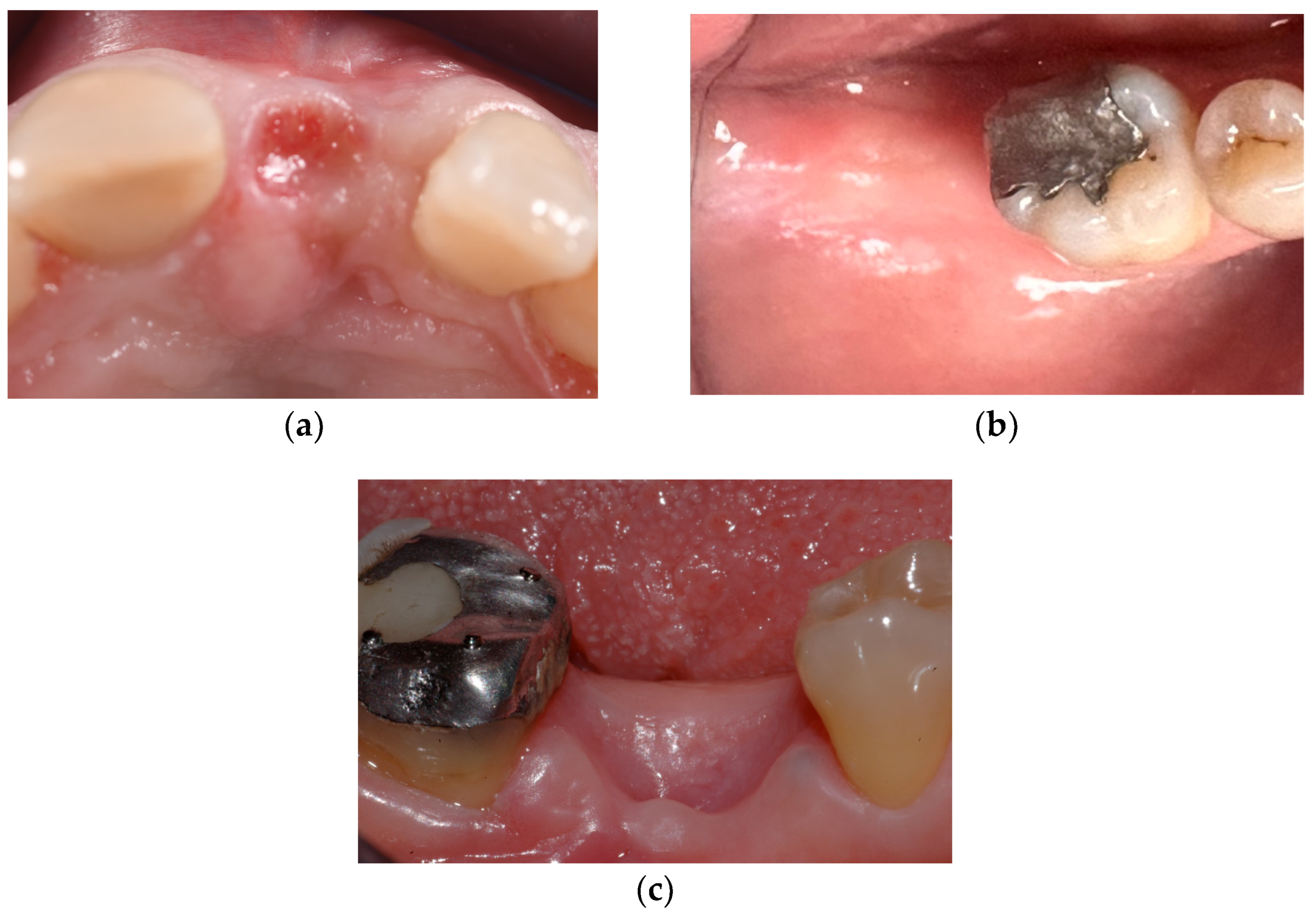 Dentistry 12 00321 g004