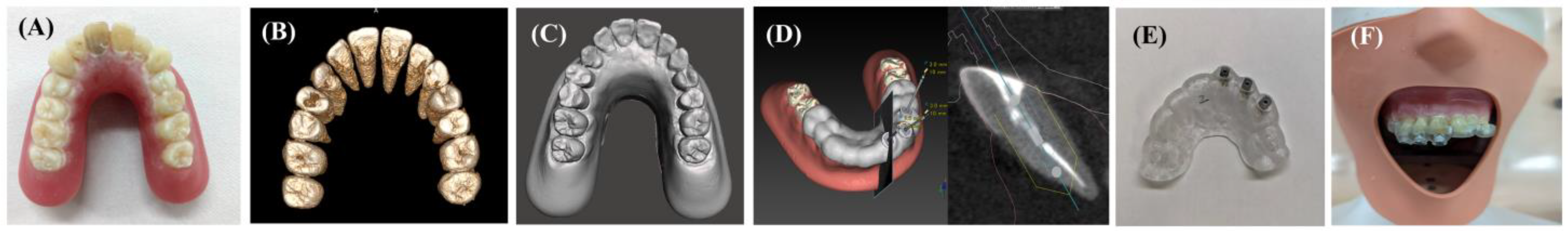 Dentistry 12 00333 g001