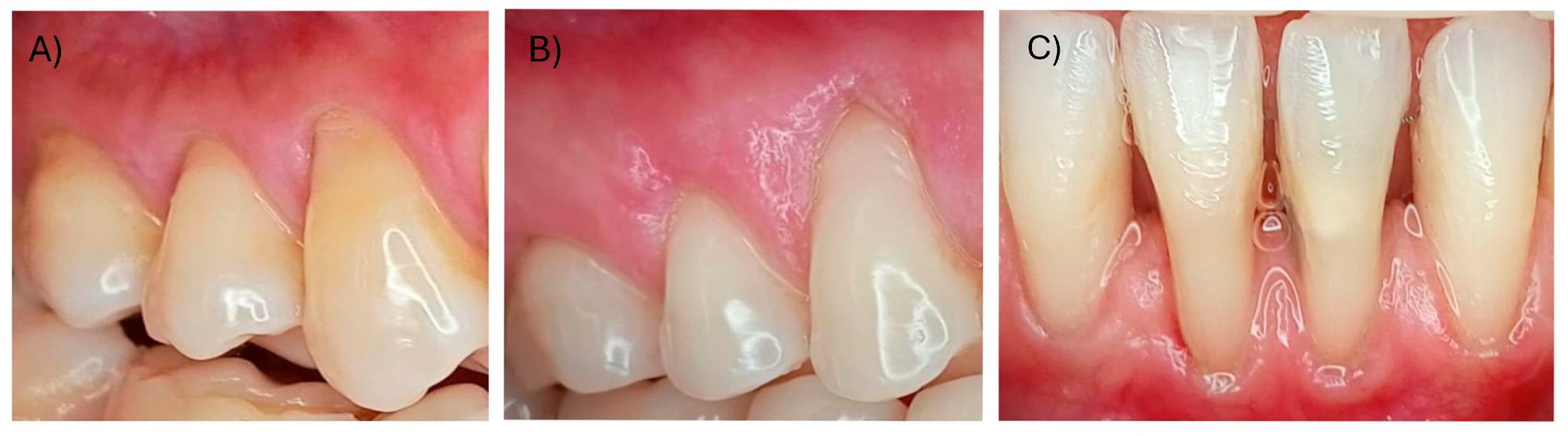 Dentistry 12 00341 g001