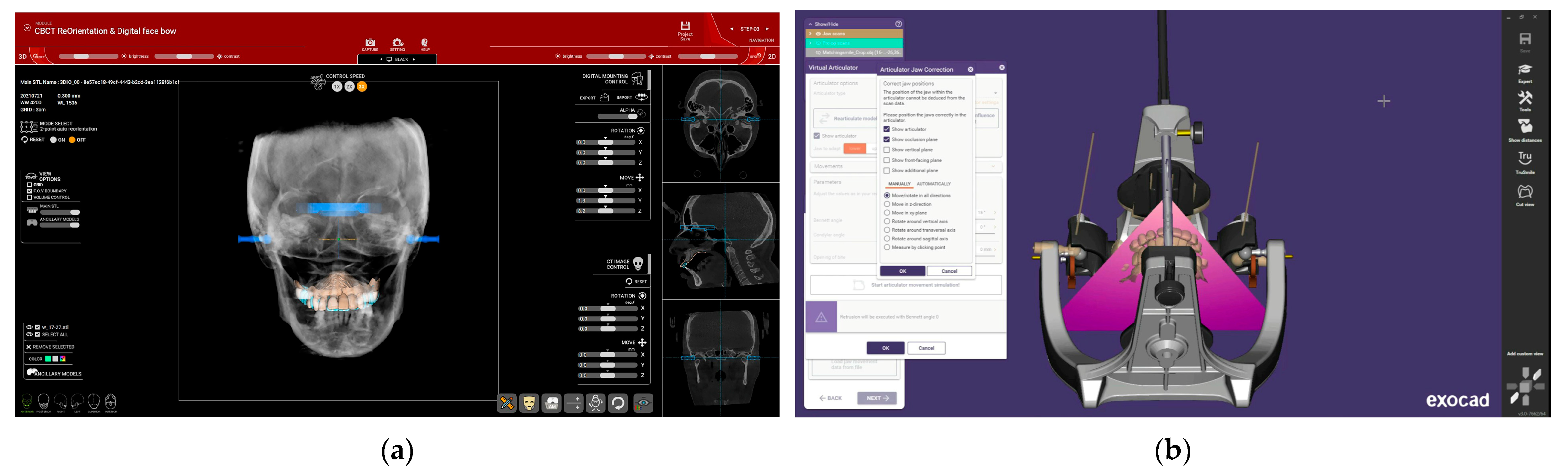 Dentistry 12 00347 g006