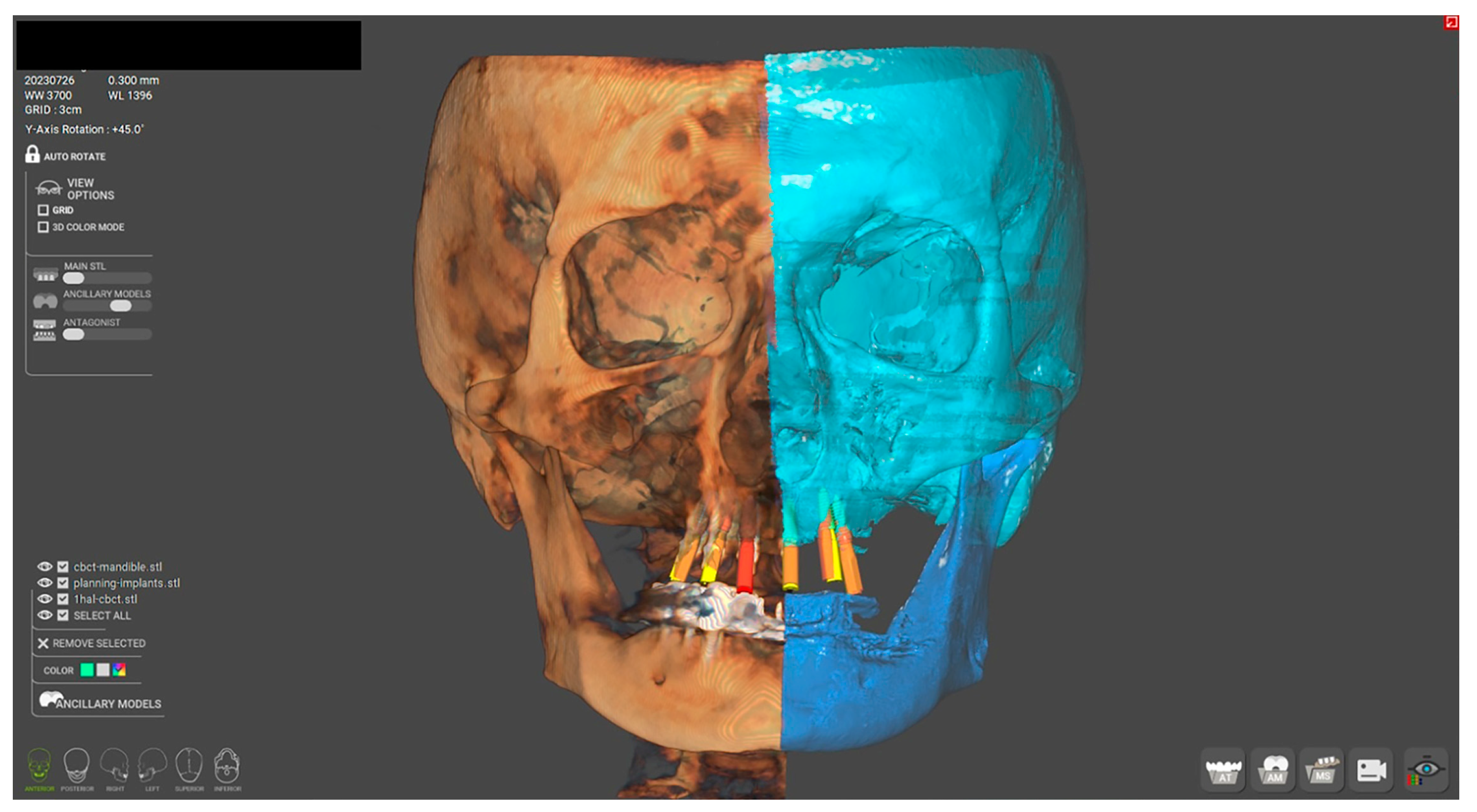 Dentistry 12 00347 g014