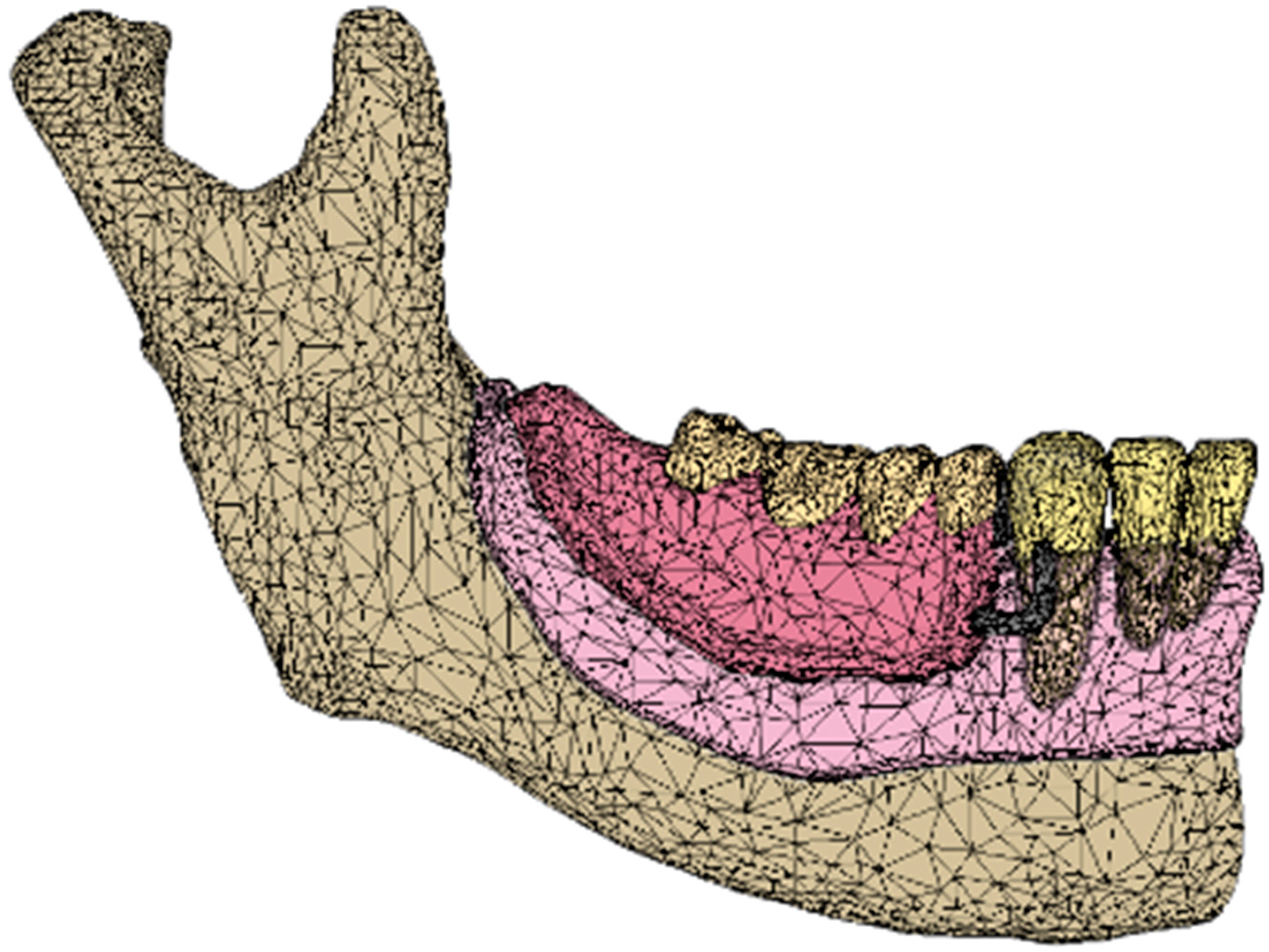 Dentistry 12 00358 g004 Dentistry 12 00358 g004