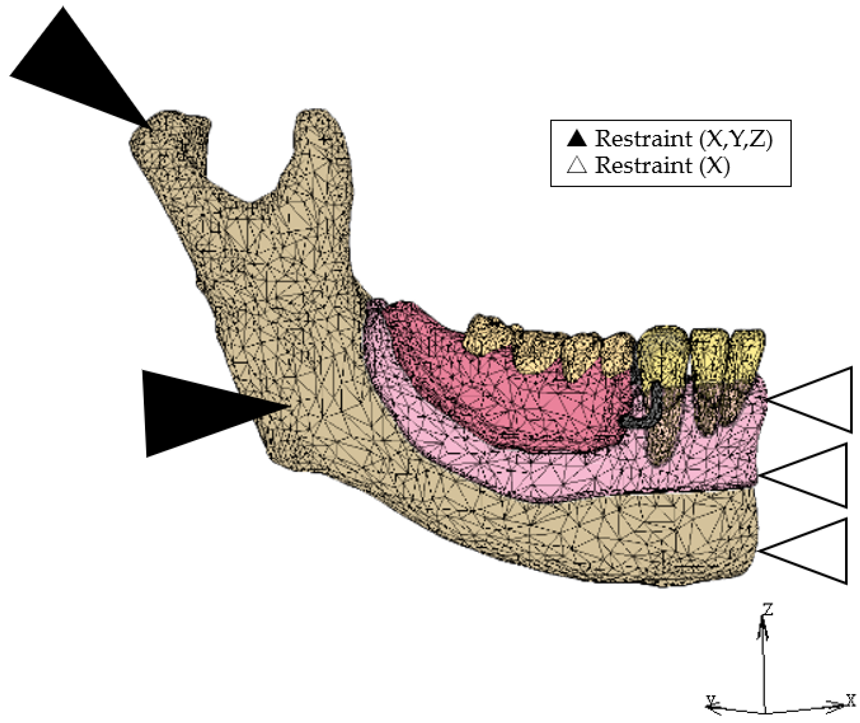 Dentistry 12 00358 g005 Dentistry 12 00358 g005