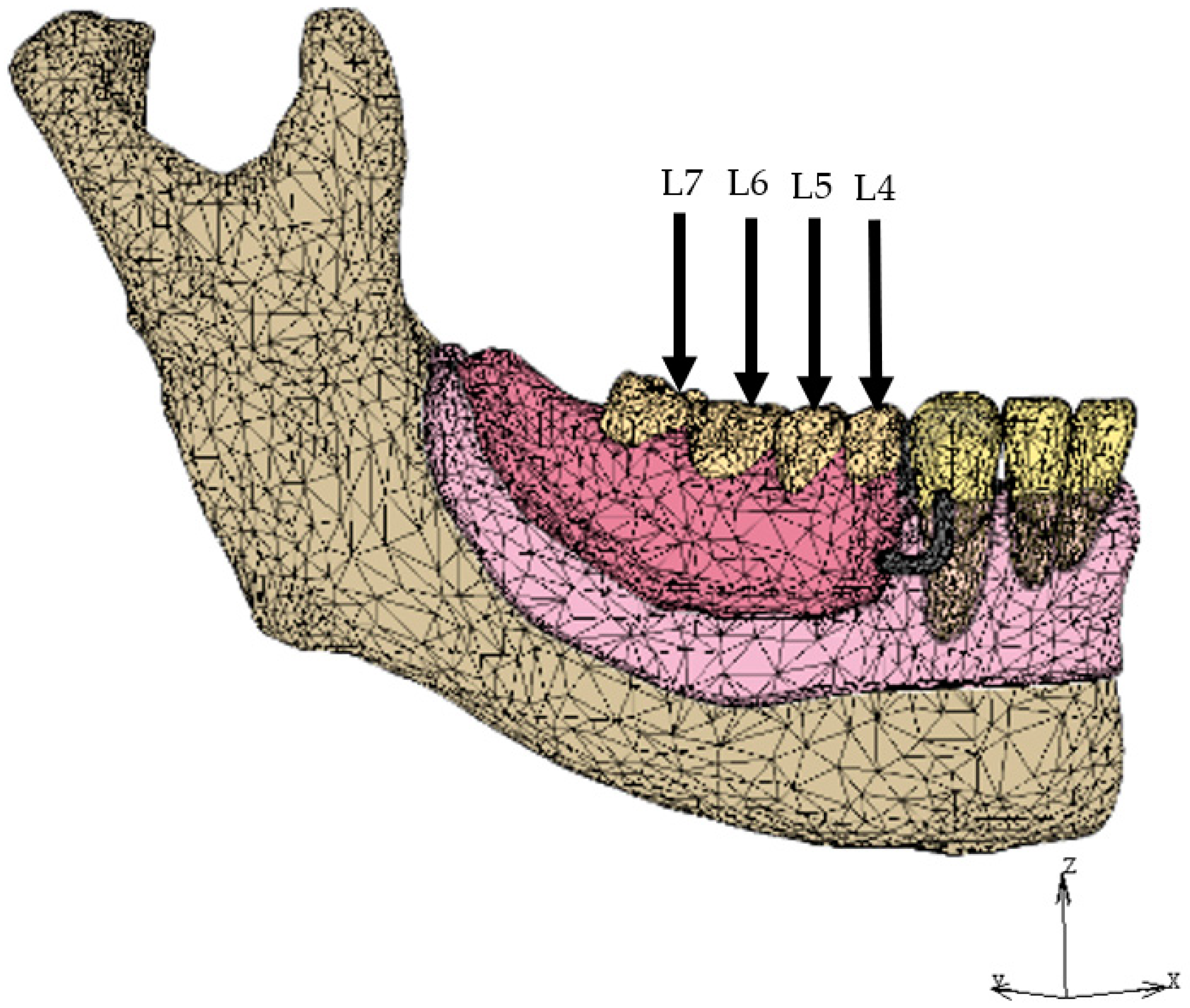 Dentistry 12 00358 g006 Dentistry 12 00358 g006