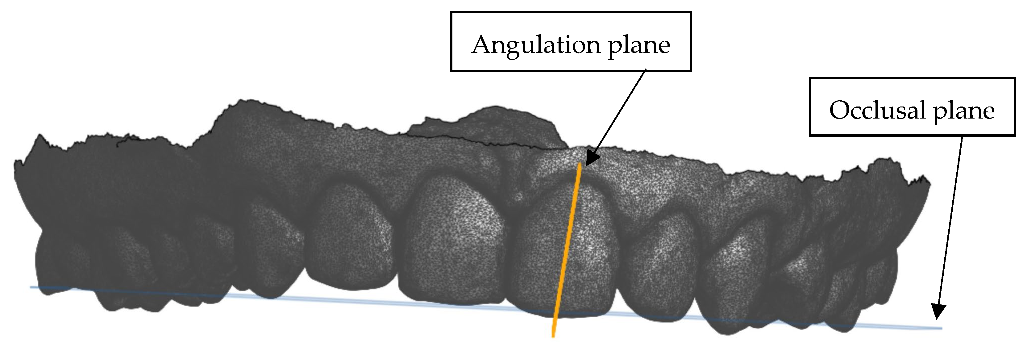 Dentistry 13 00002 g003