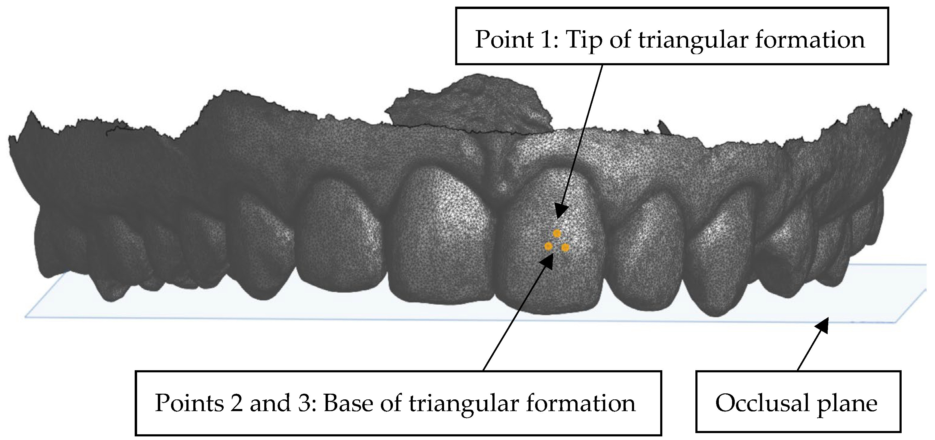 Dentistry 13 00002 g004