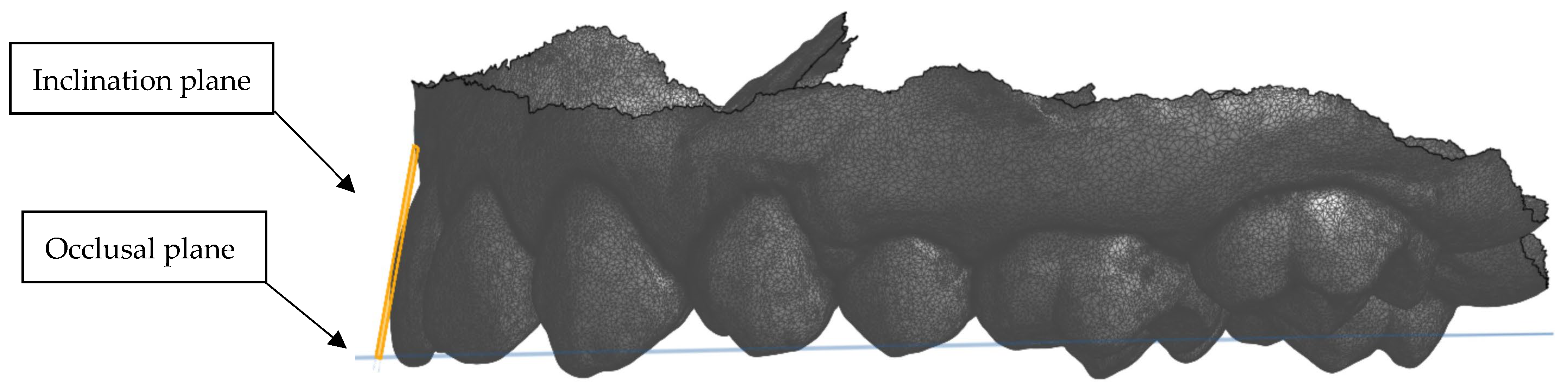 Dentistry 13 00002 g005