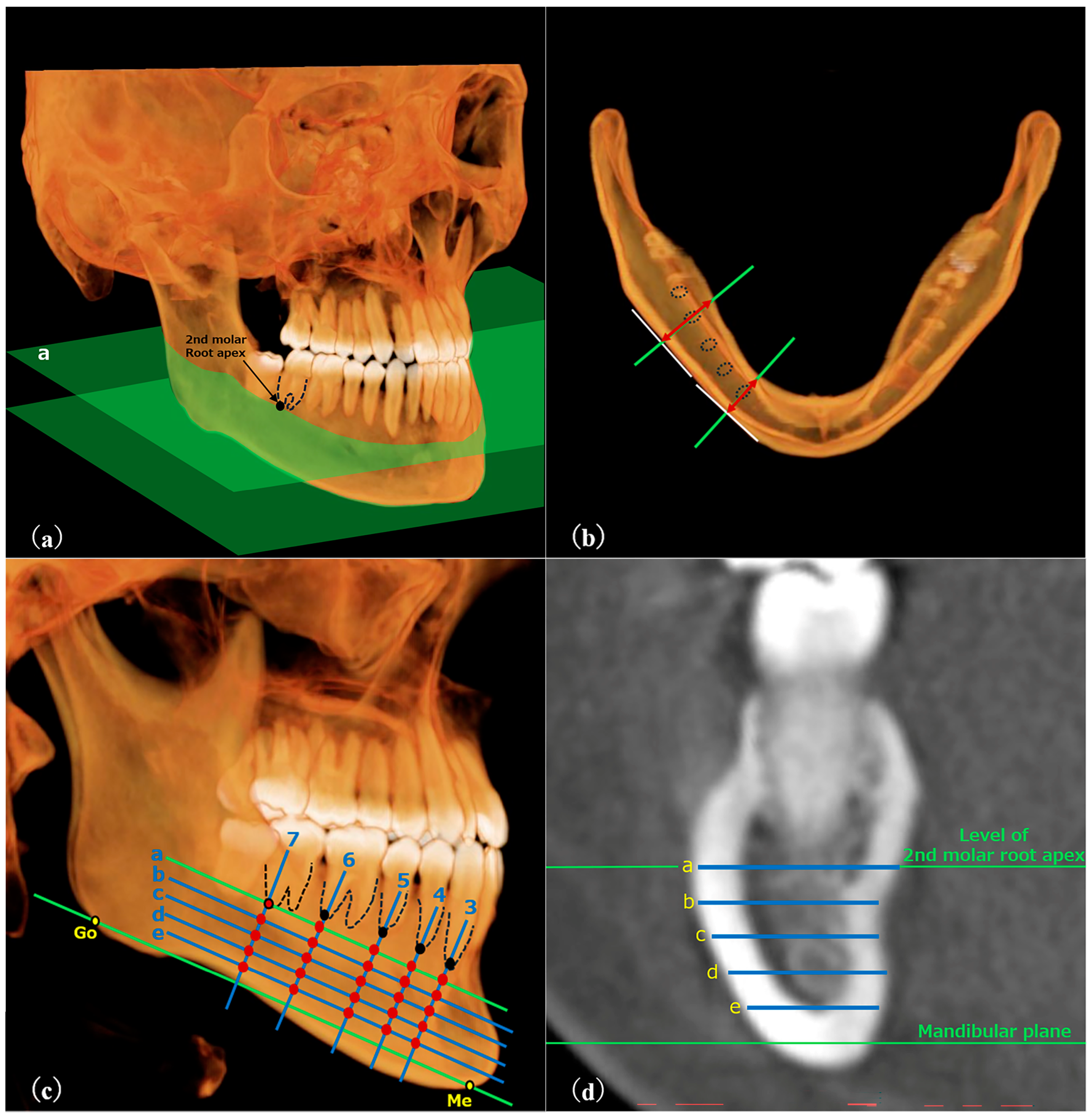 Dentistry 13 00003 g003