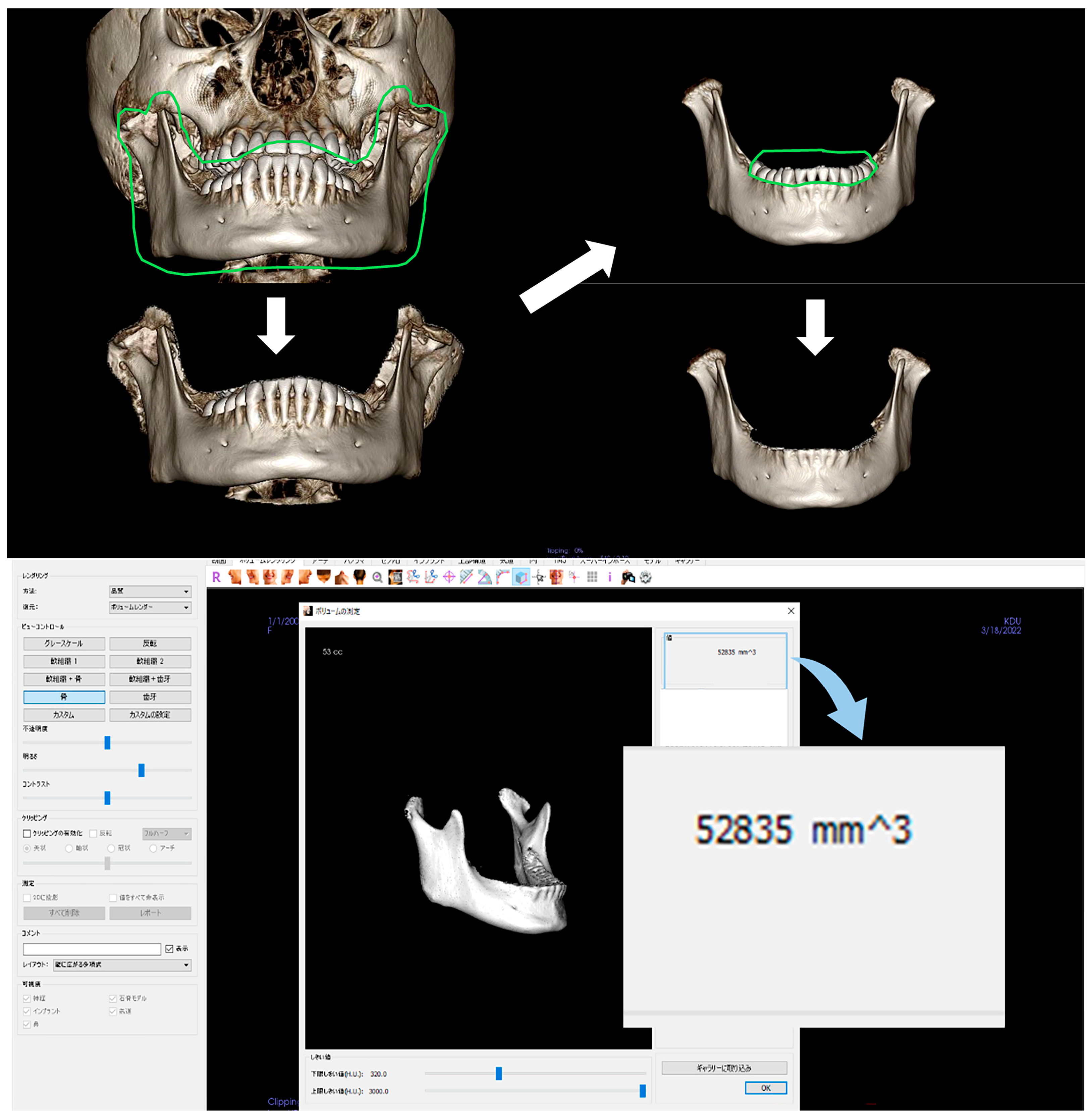 Dentistry 13 00003 g004