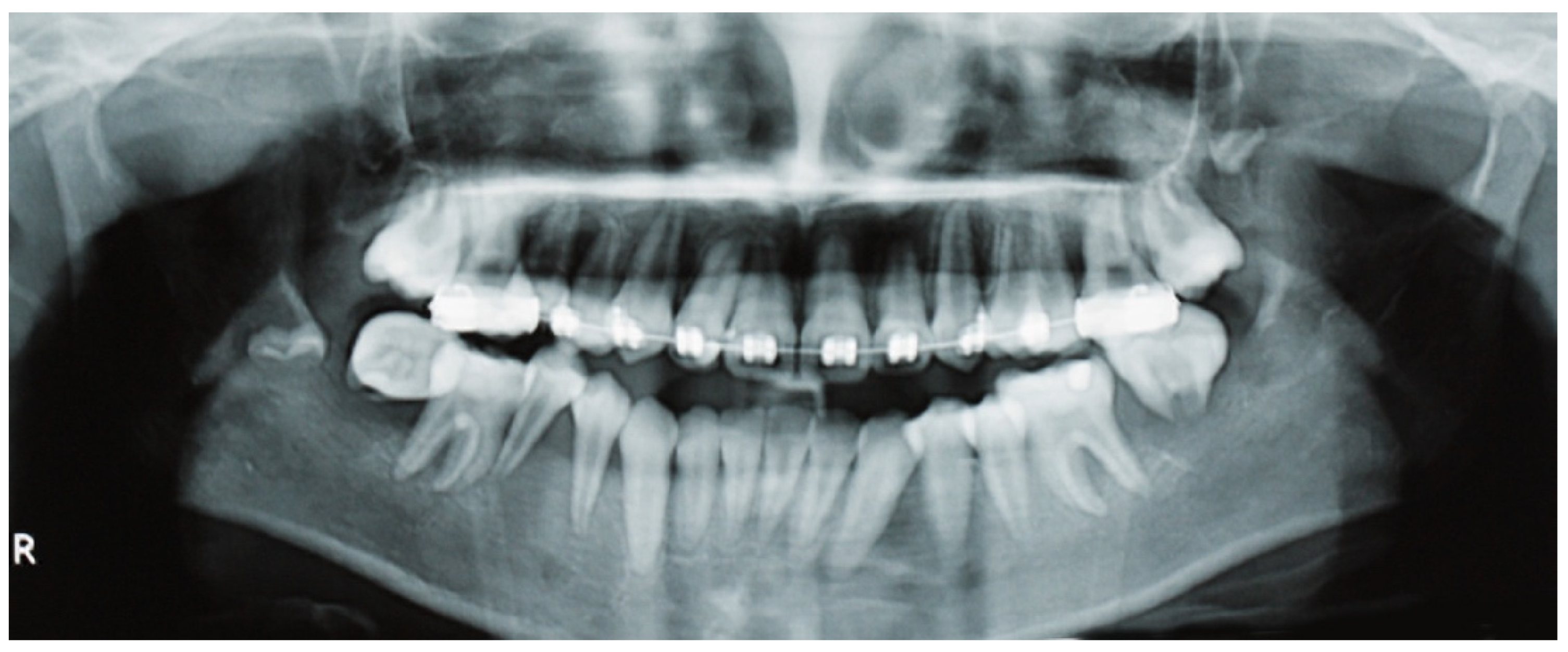 Dentistry 13 00006 g002 Dentistry 13 00006 g002