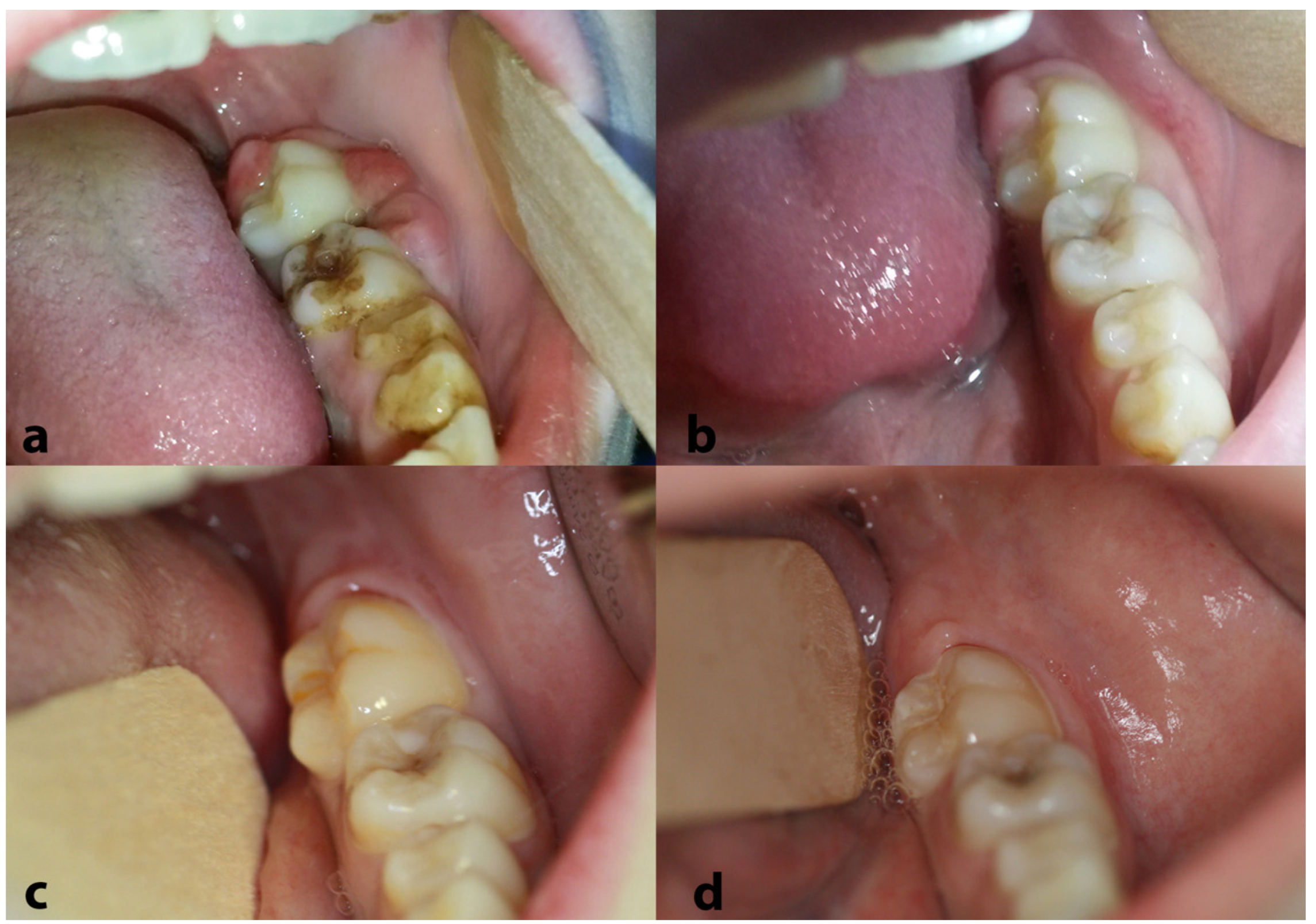 Dentistry 13 00006 g007 Dentistry 13 00006 g007