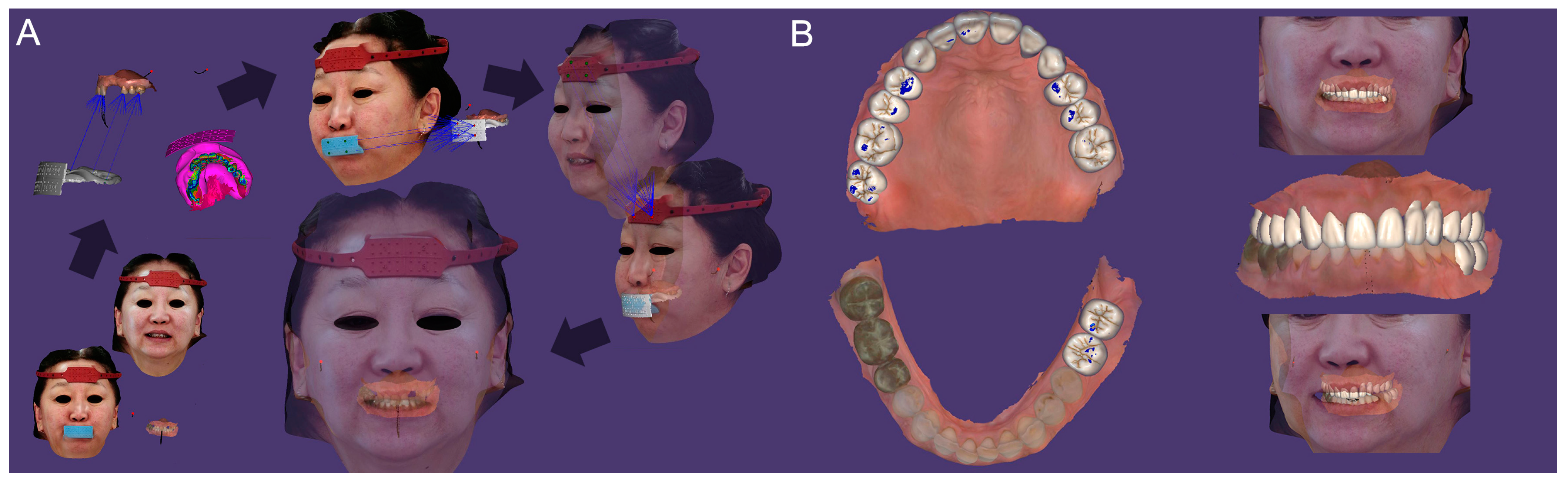 Dentistry 13 00007 g003