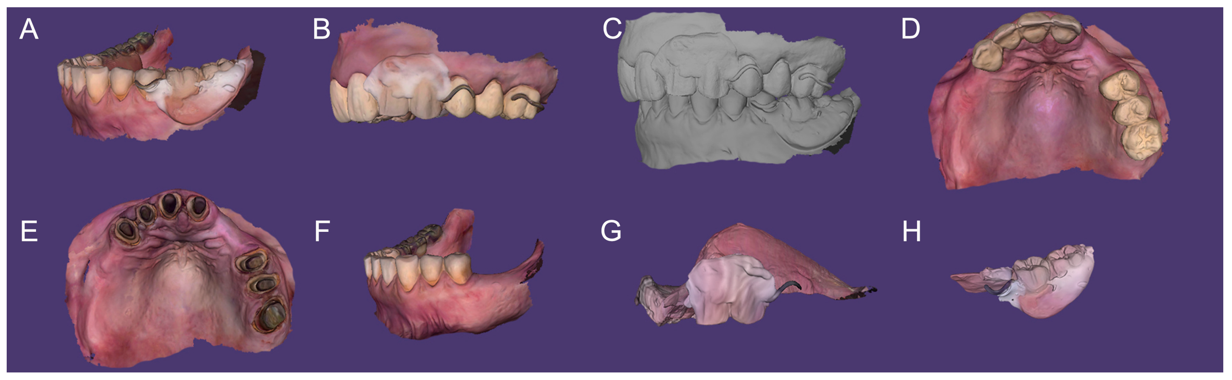 Dentistry 13 00007 g005