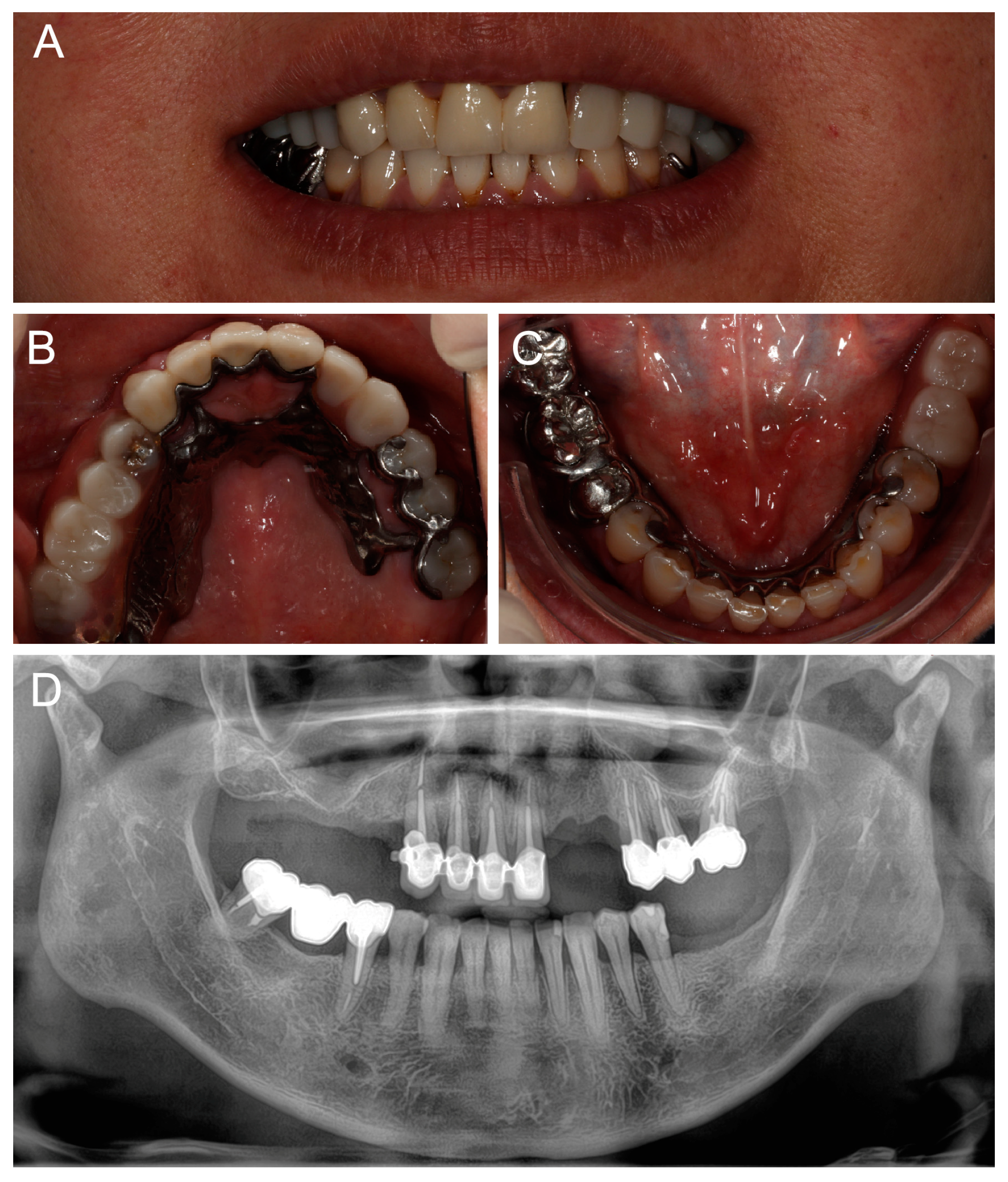 Dentistry 13 00007 g008