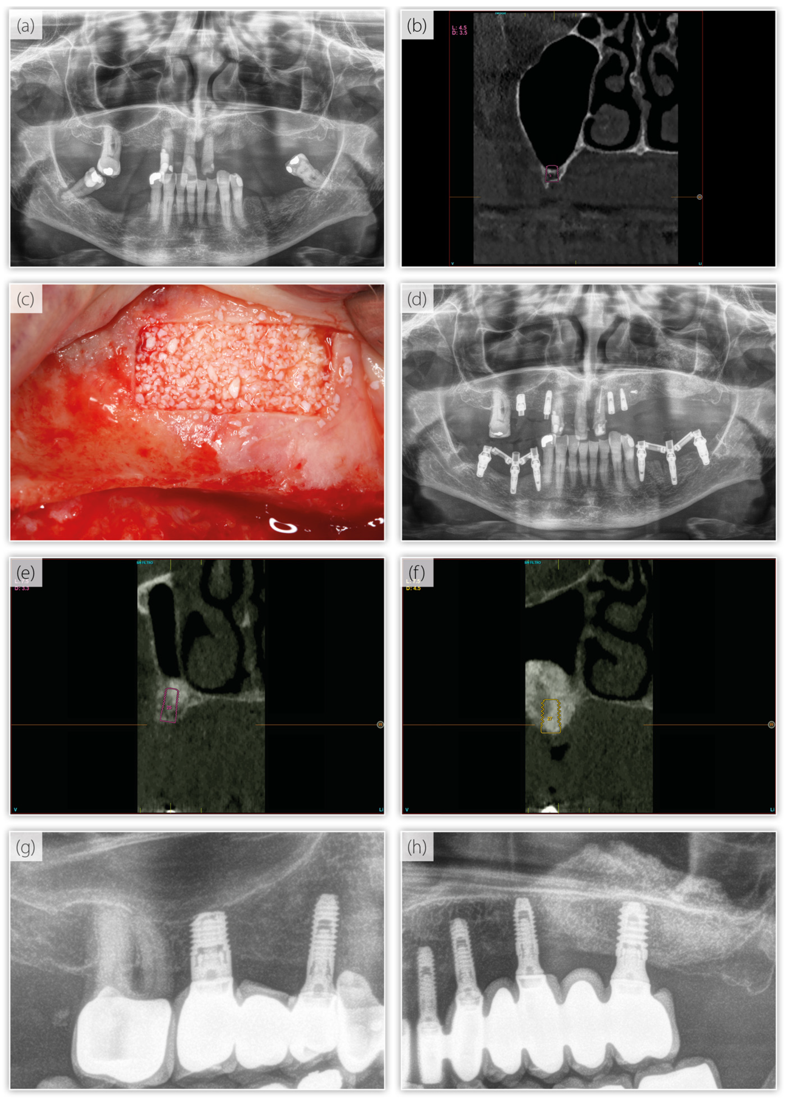 Dentistry 13 00012 g005