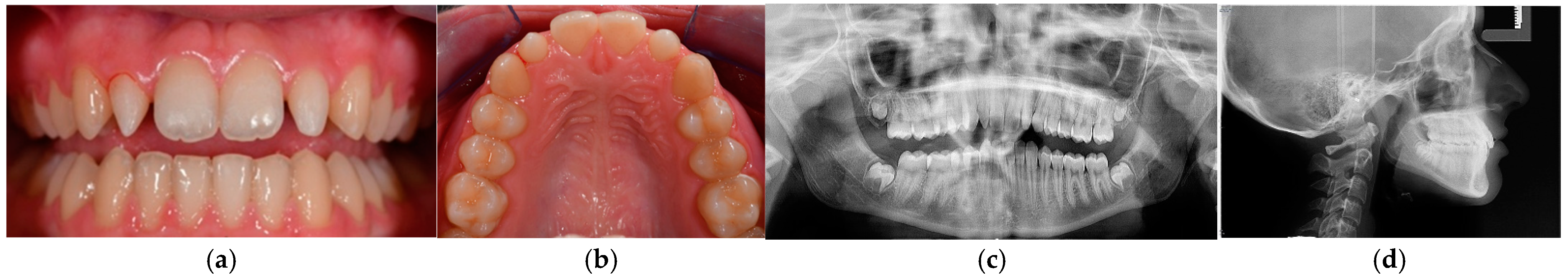 Dentistry 13 00018 g001