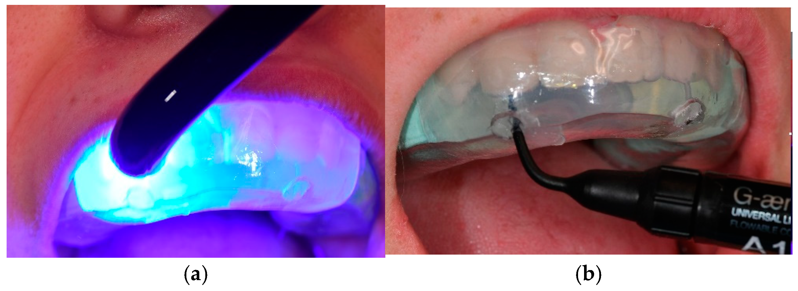 Dentistry 13 00018 g004