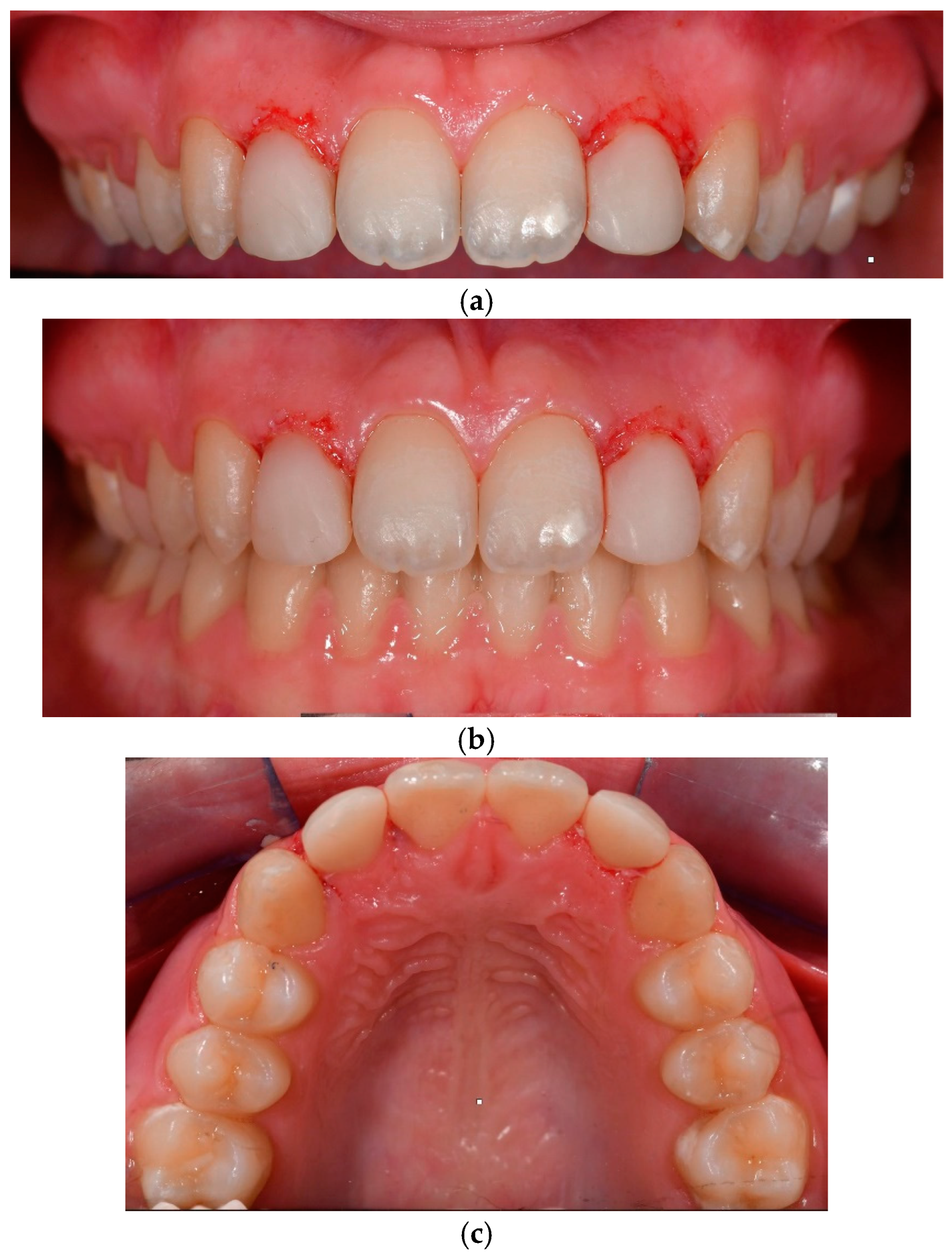 Dentistry 13 00018 g005