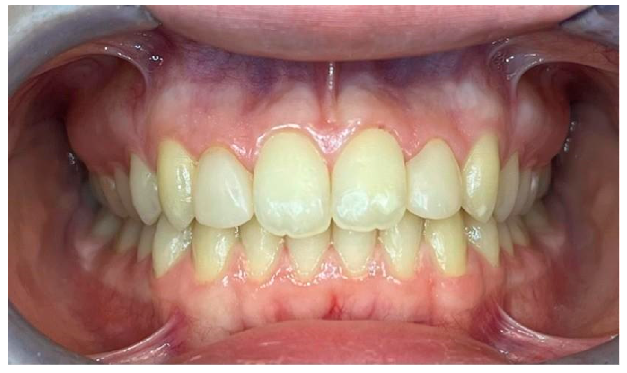 Dentistry 13 00018 g006