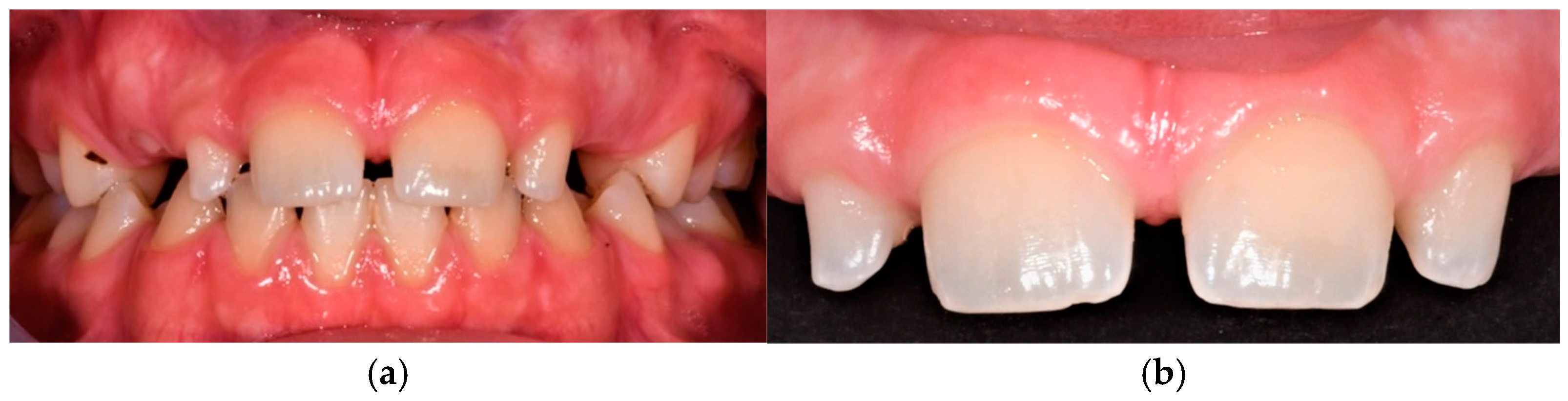 Dentistry 13 00018 g007