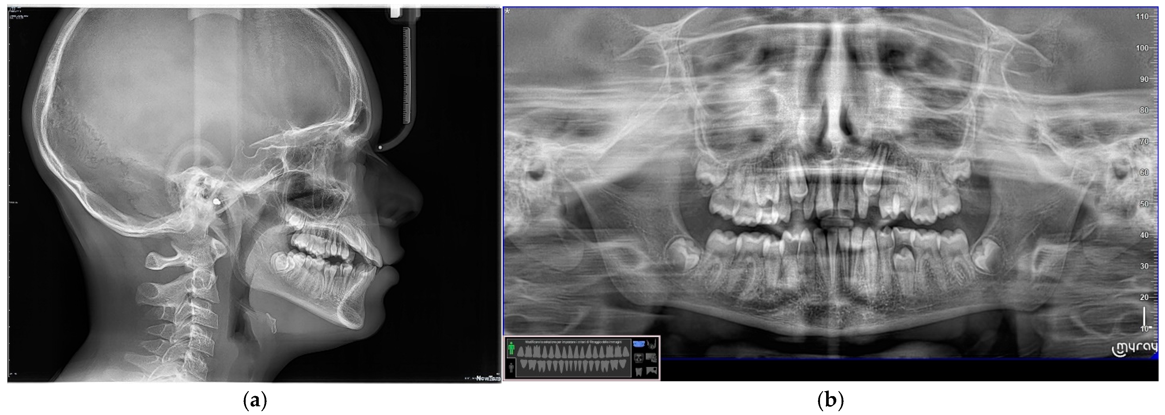 Dentistry 13 00018 g008