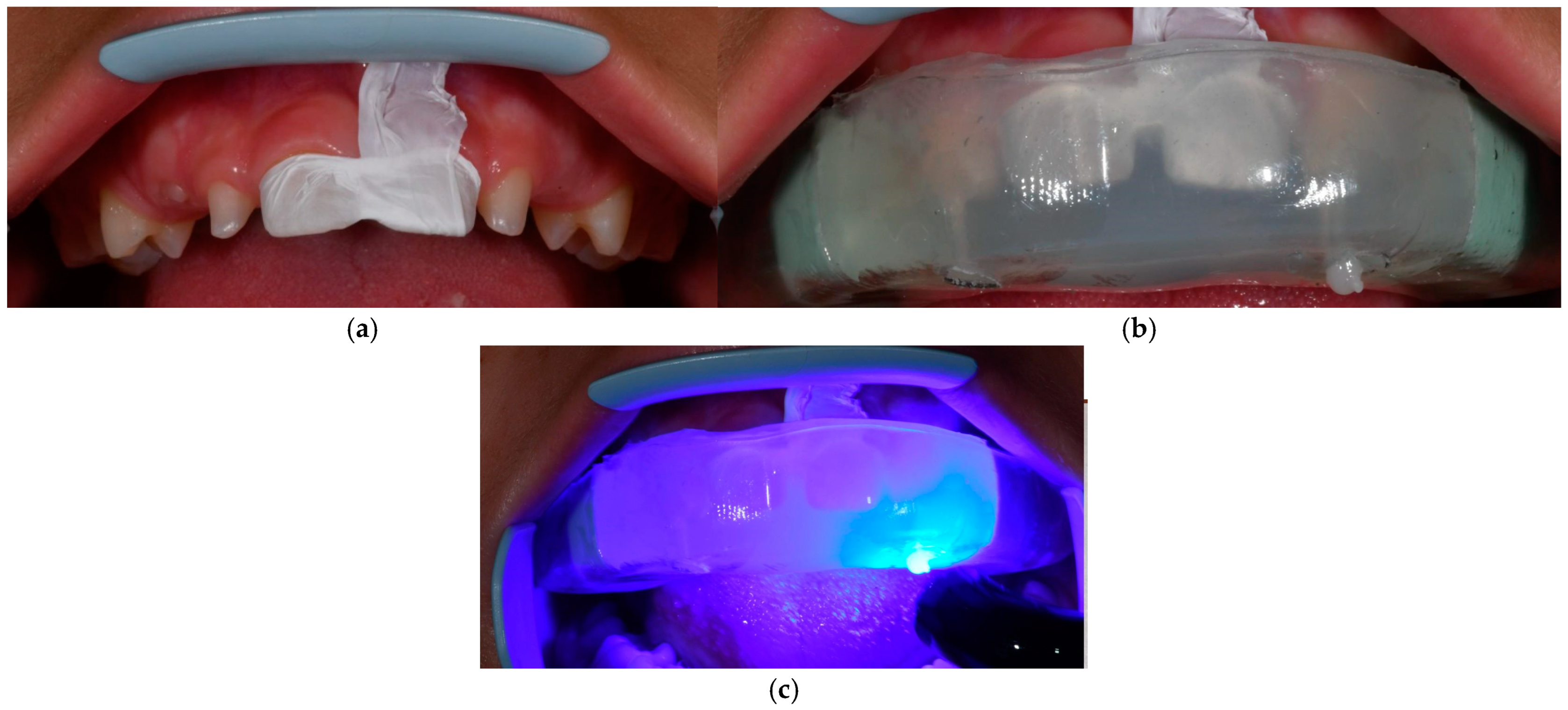 Dentistry 13 00018 g010