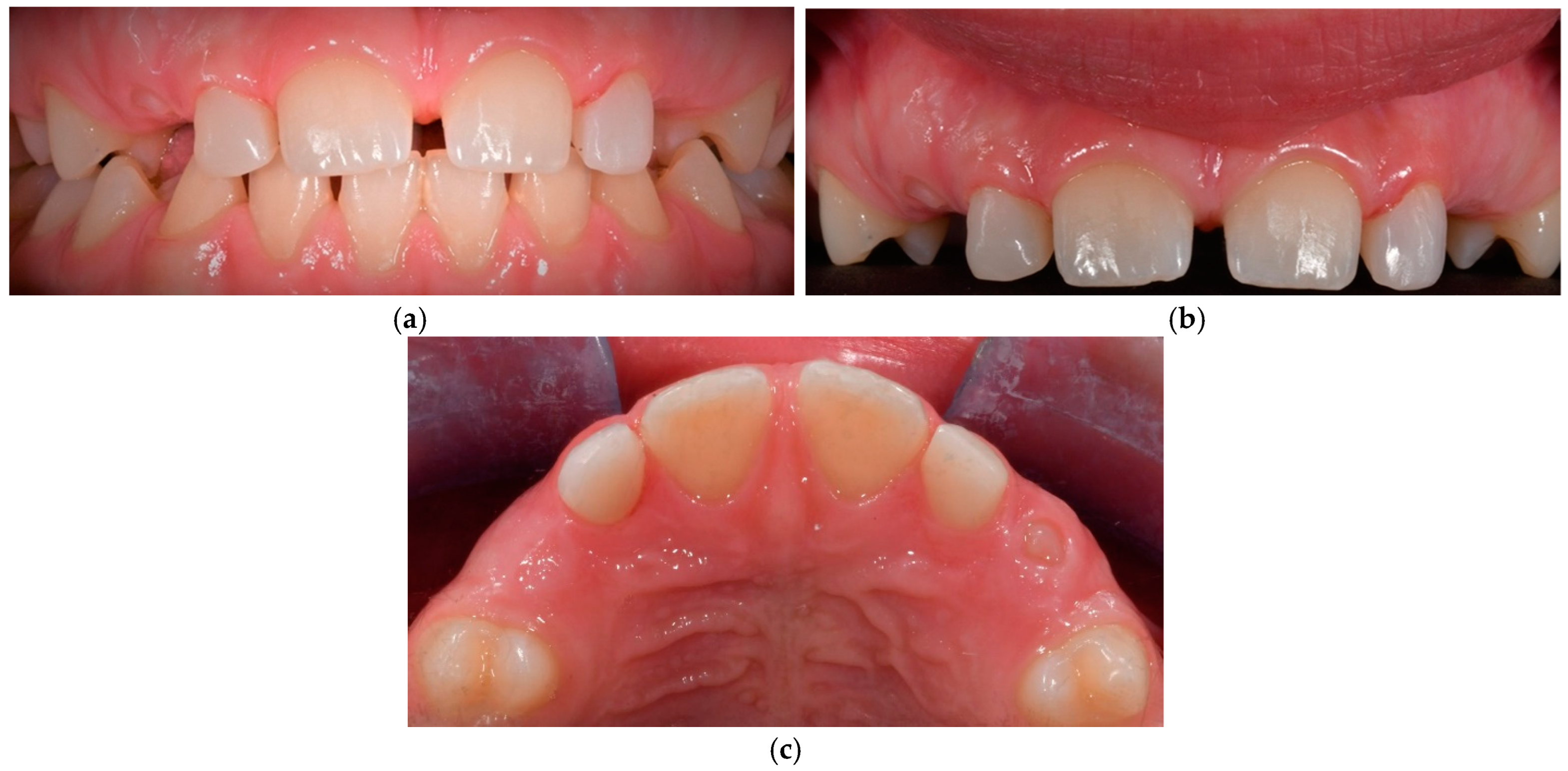 Dentistry 13 00018 g011