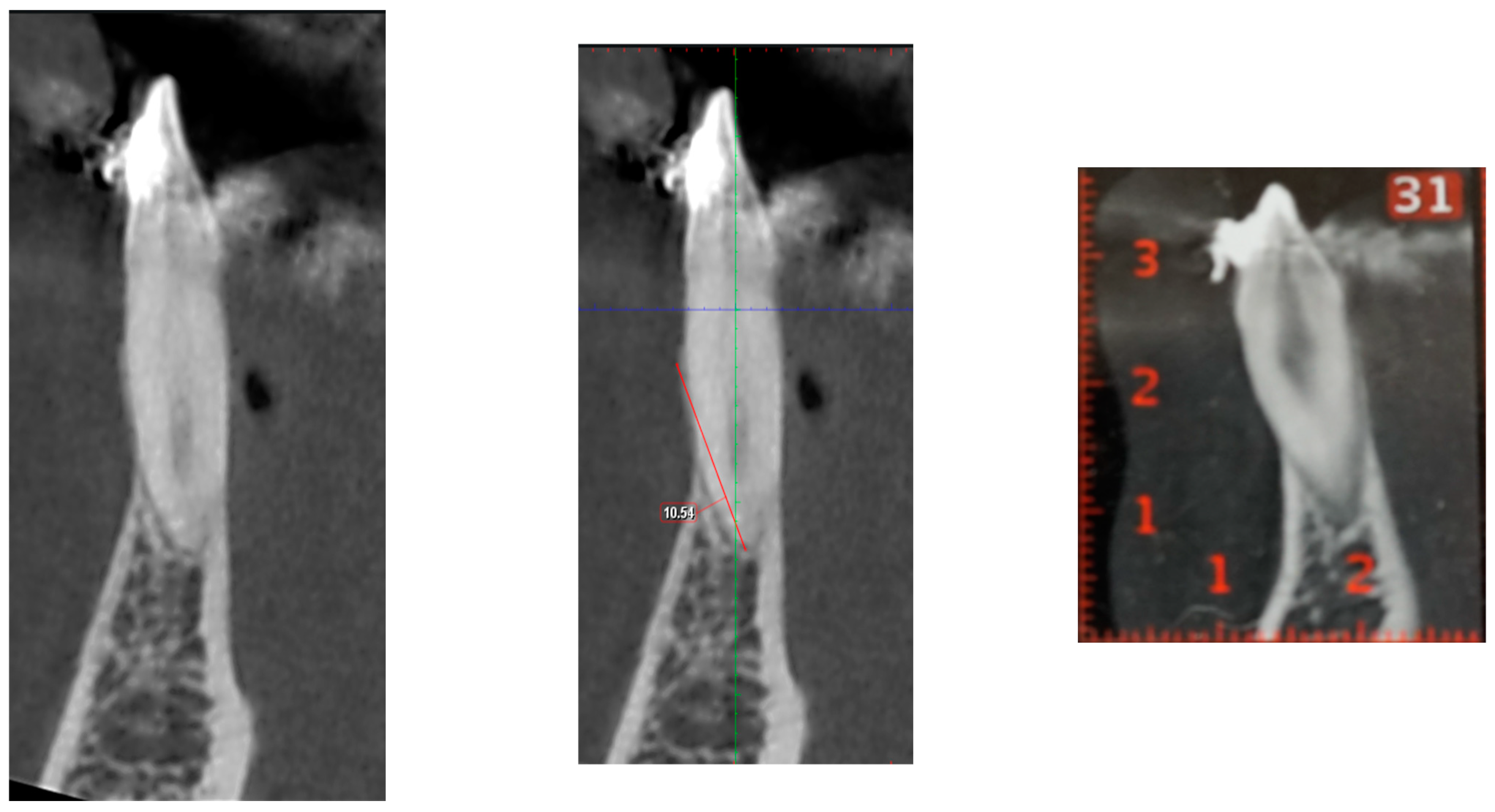 Dentistry 13 00022 g002