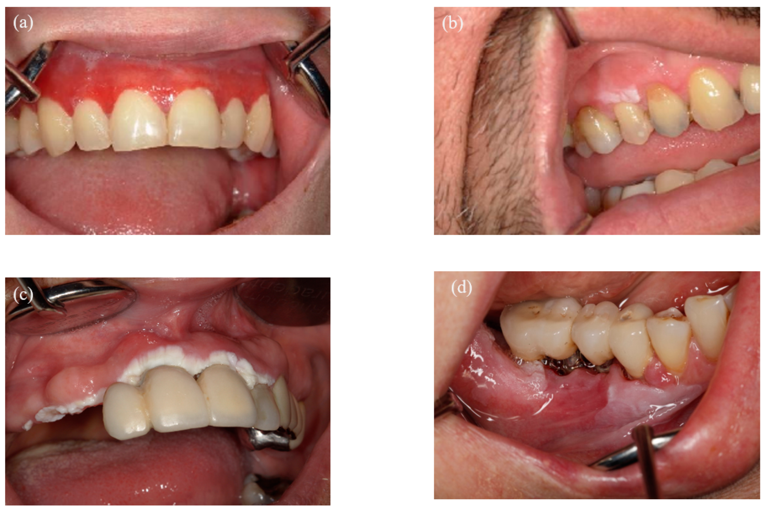 Dentistry 13 00035 g001