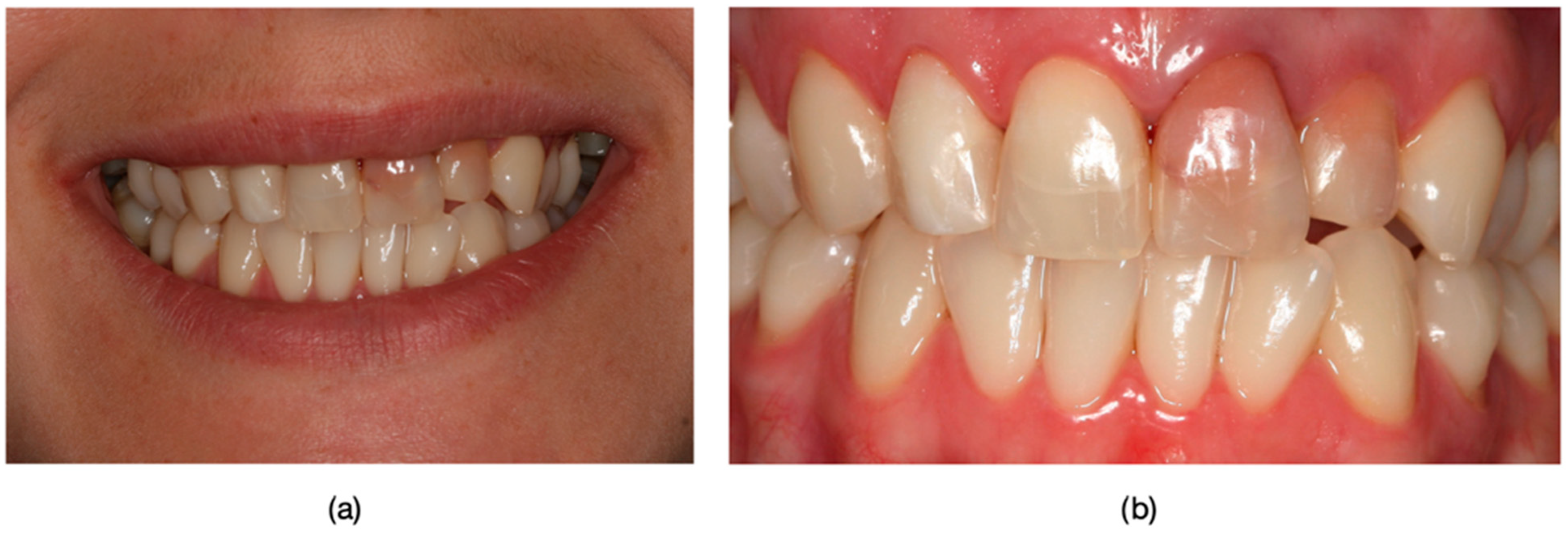 Dentistry 13 00044 g002